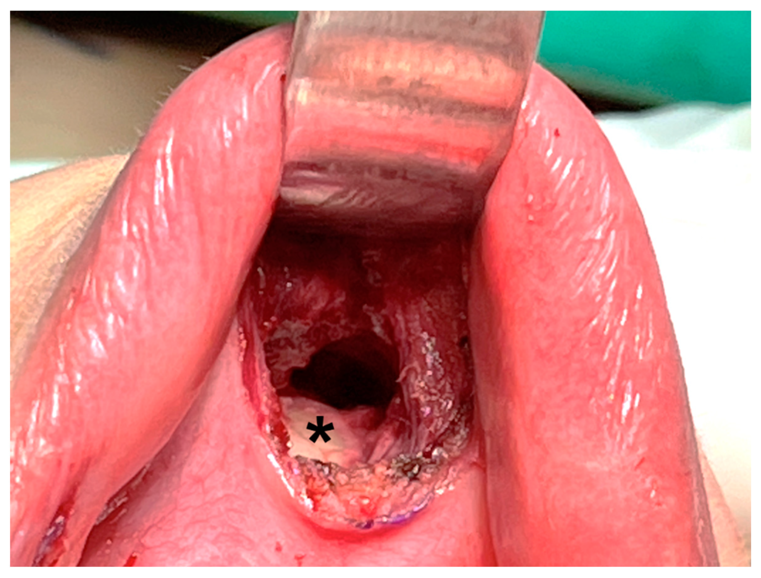 Cancers 14 01031 g004