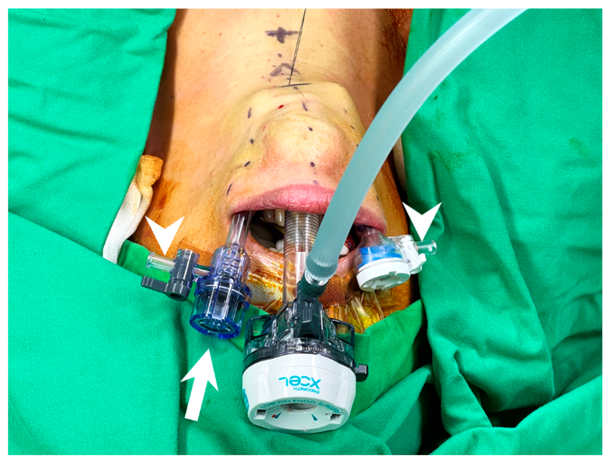 Cancers 14 01031 g005