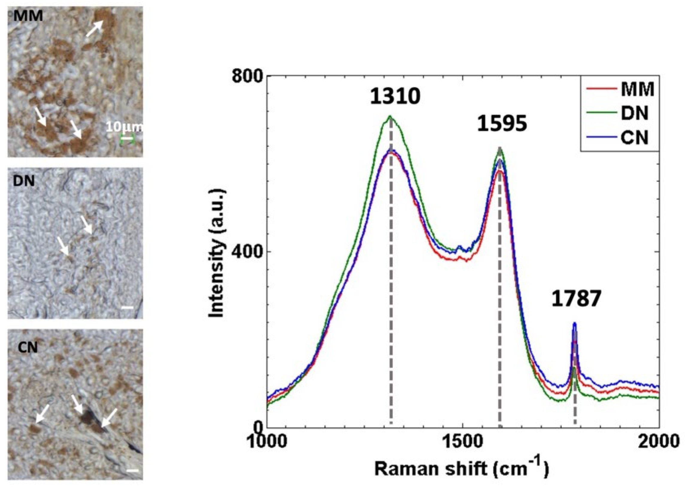 Cancers 14 01056 g001