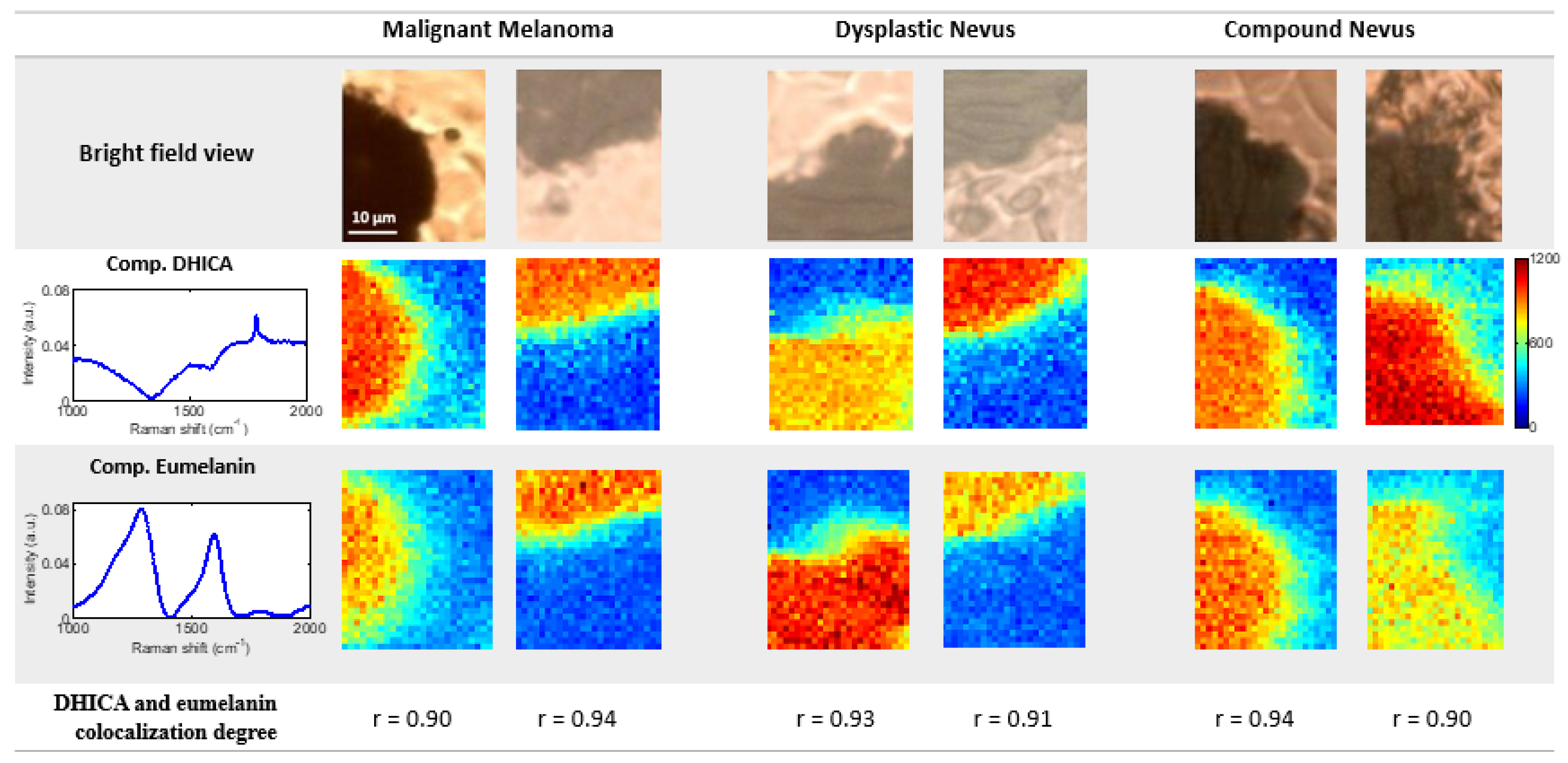 Cancers 14 01056 g003