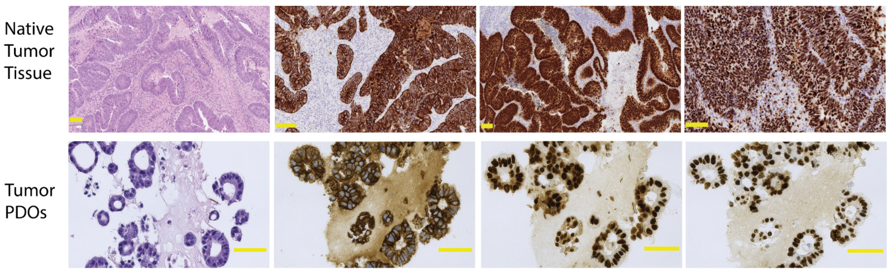 Cancers 14 01069 g002