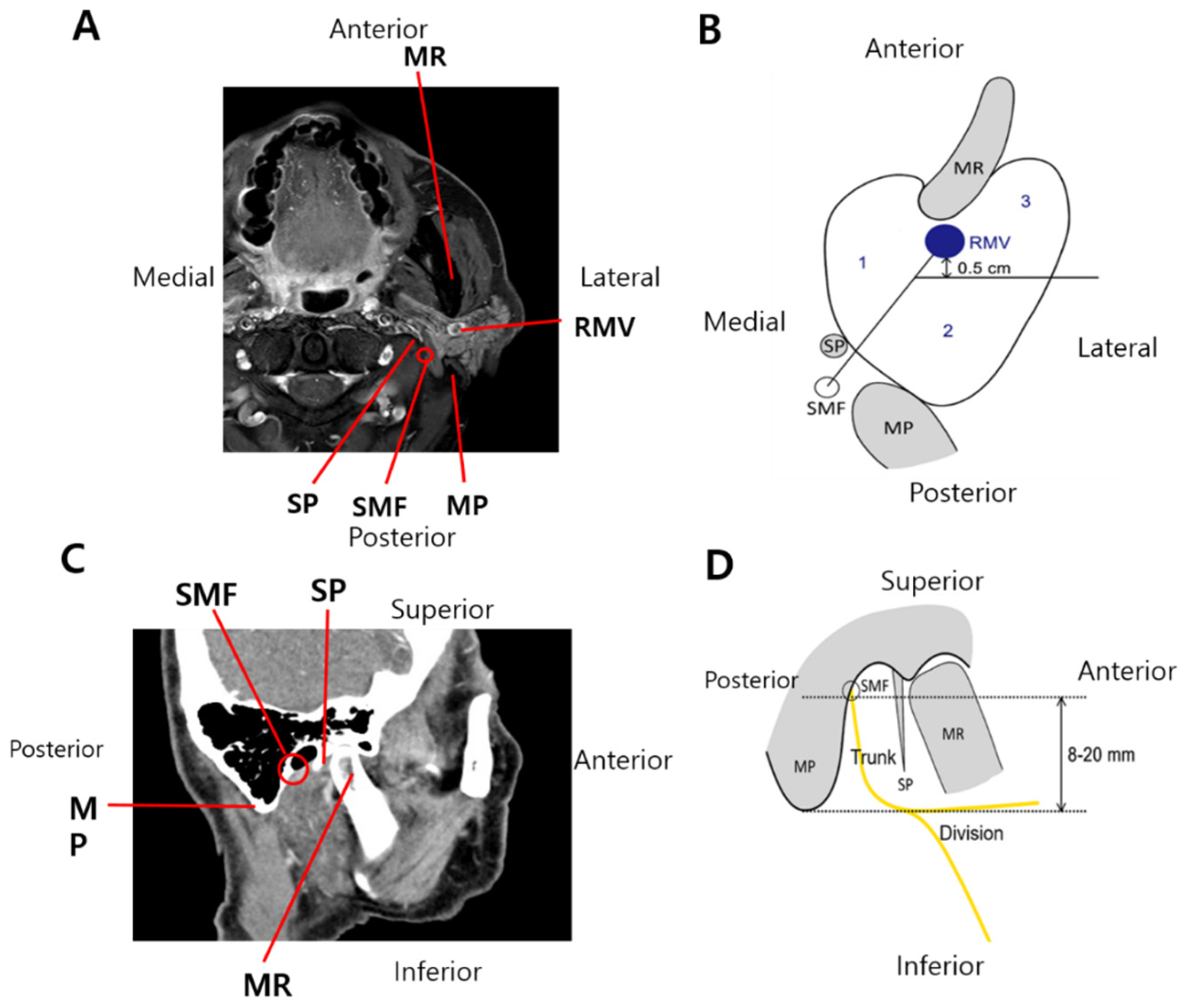 Cancers 14 01086 g002
