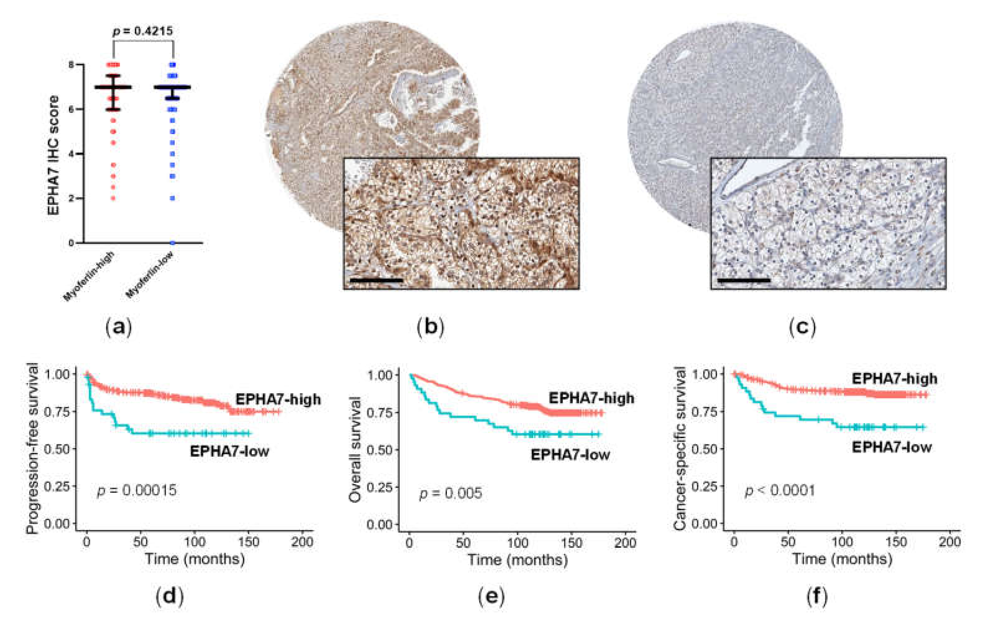 Cancers 14 01095 g003