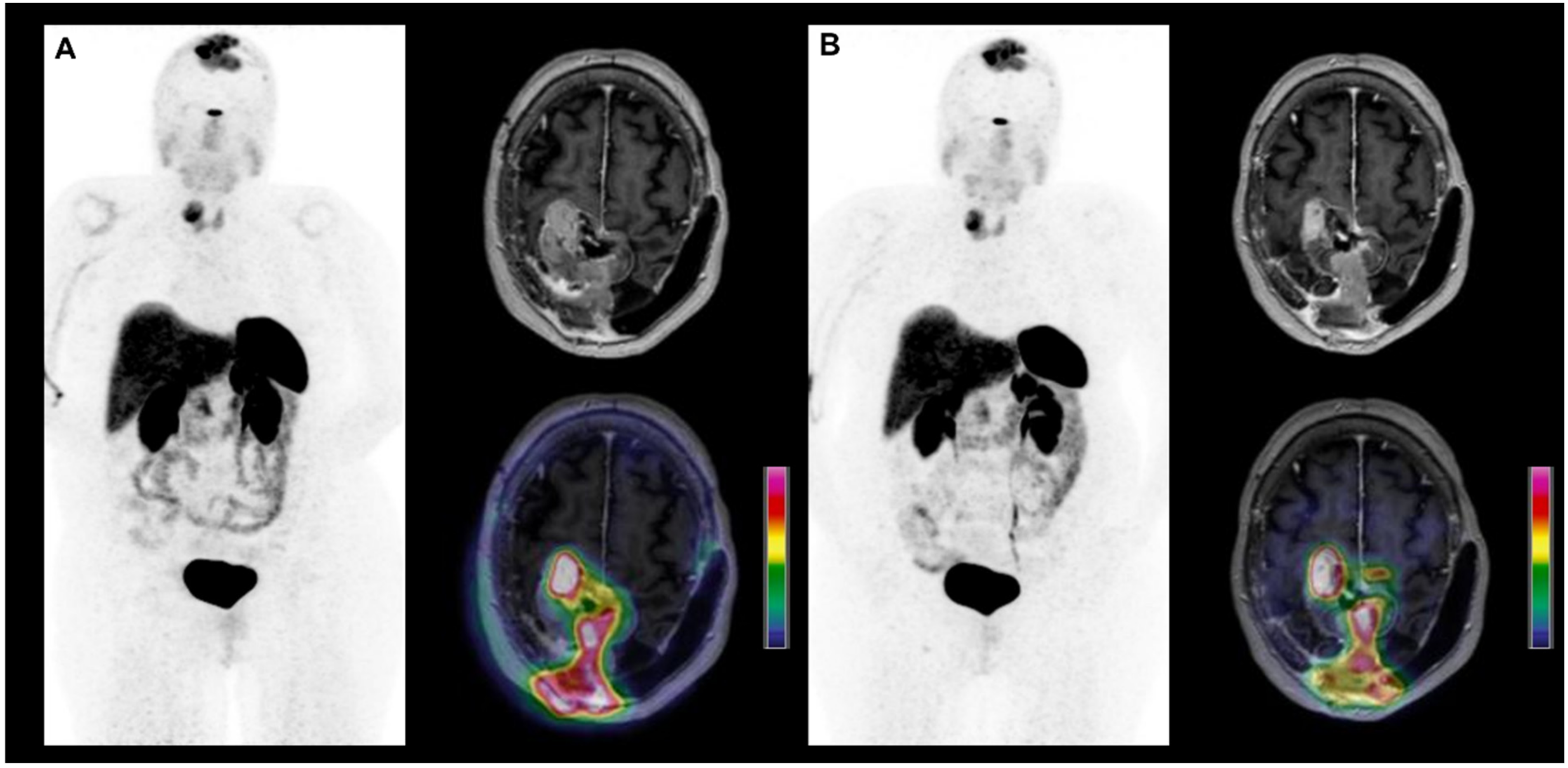 Cancers 14 01103 g003