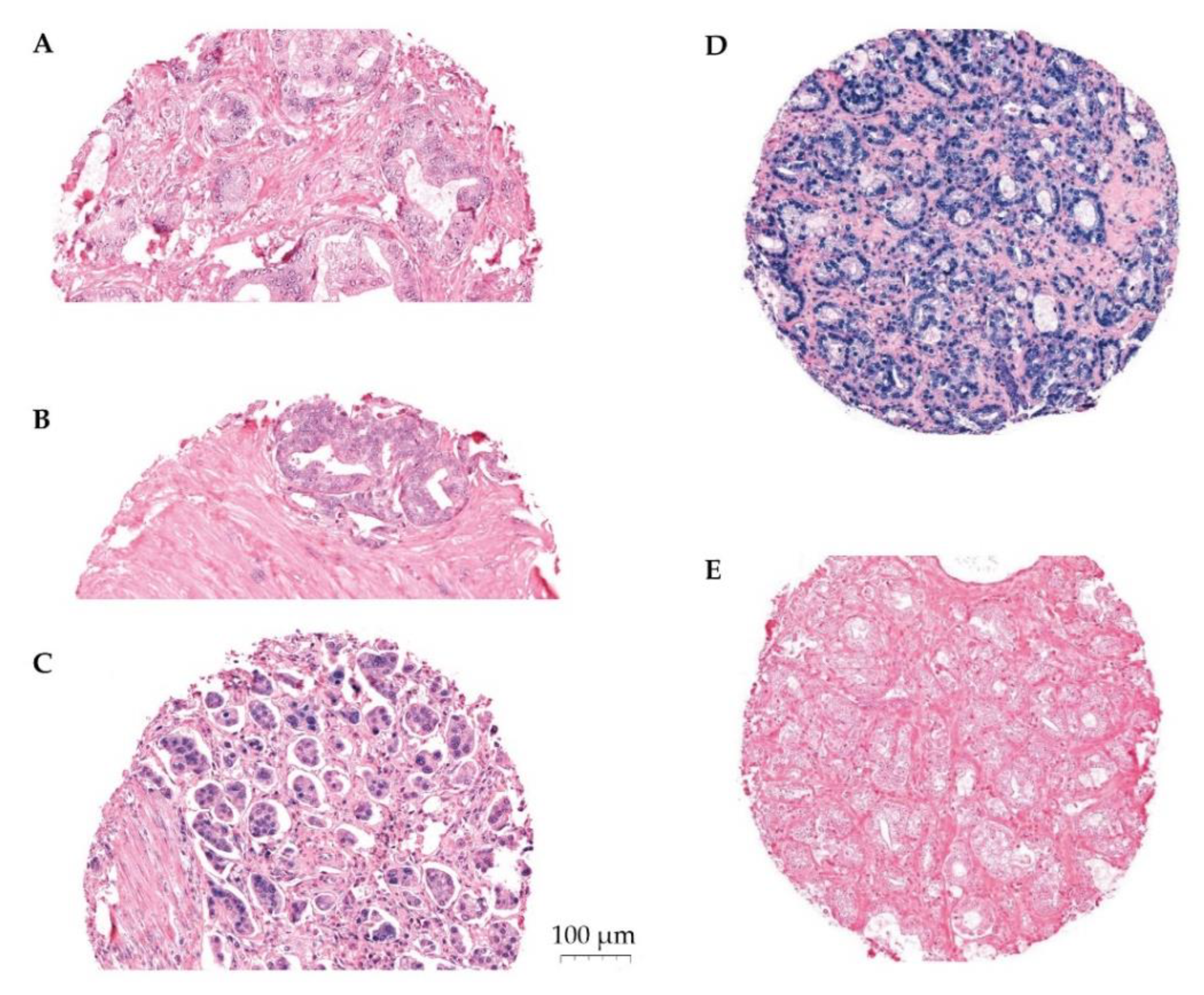 Cancers 14 01142 g001