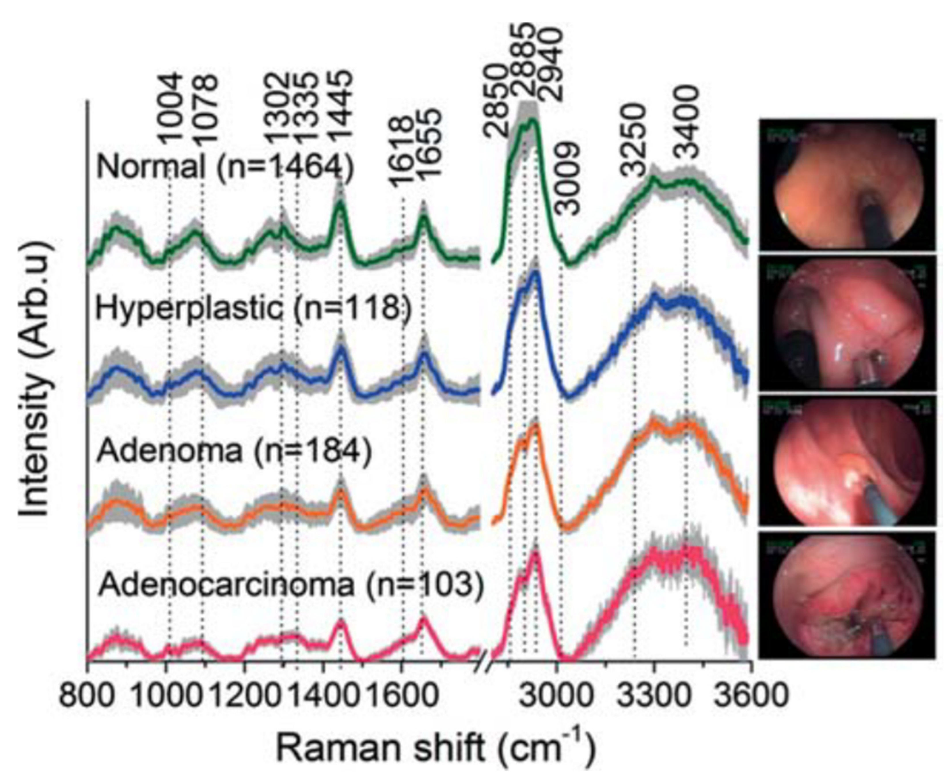 Cancers 14 01144 g001 Cancers 14 01144 g001