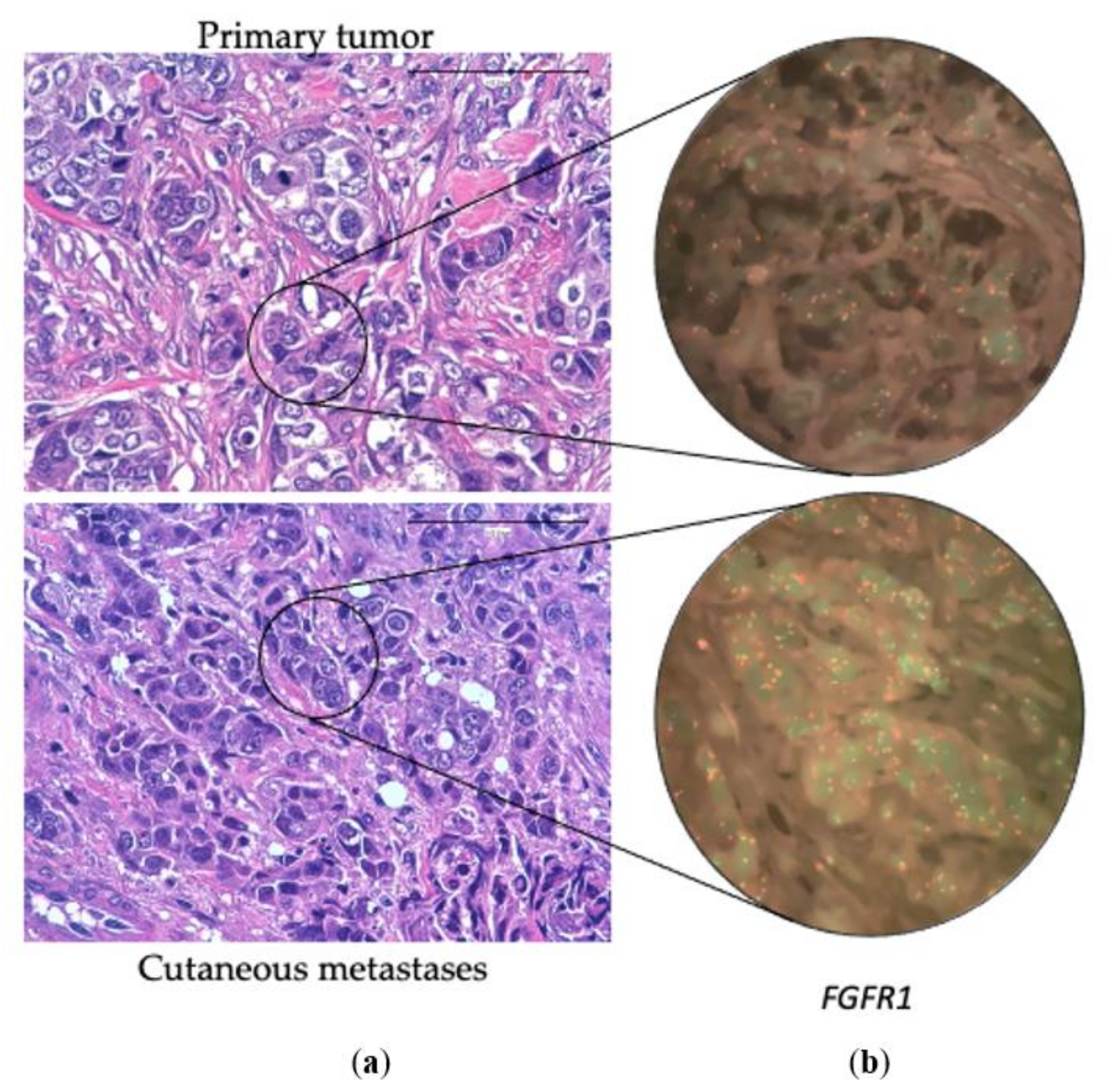 Cancers 14 01151 g002