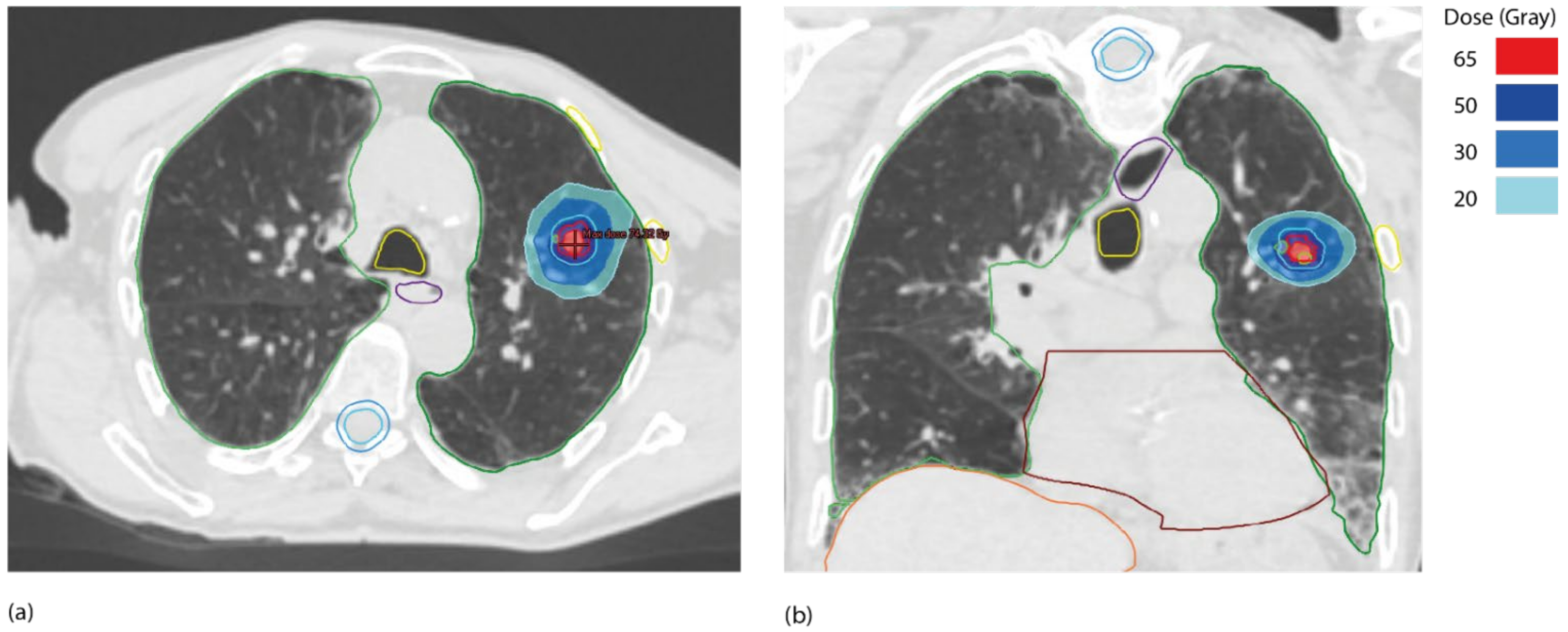 Cancers 14 01152 g003