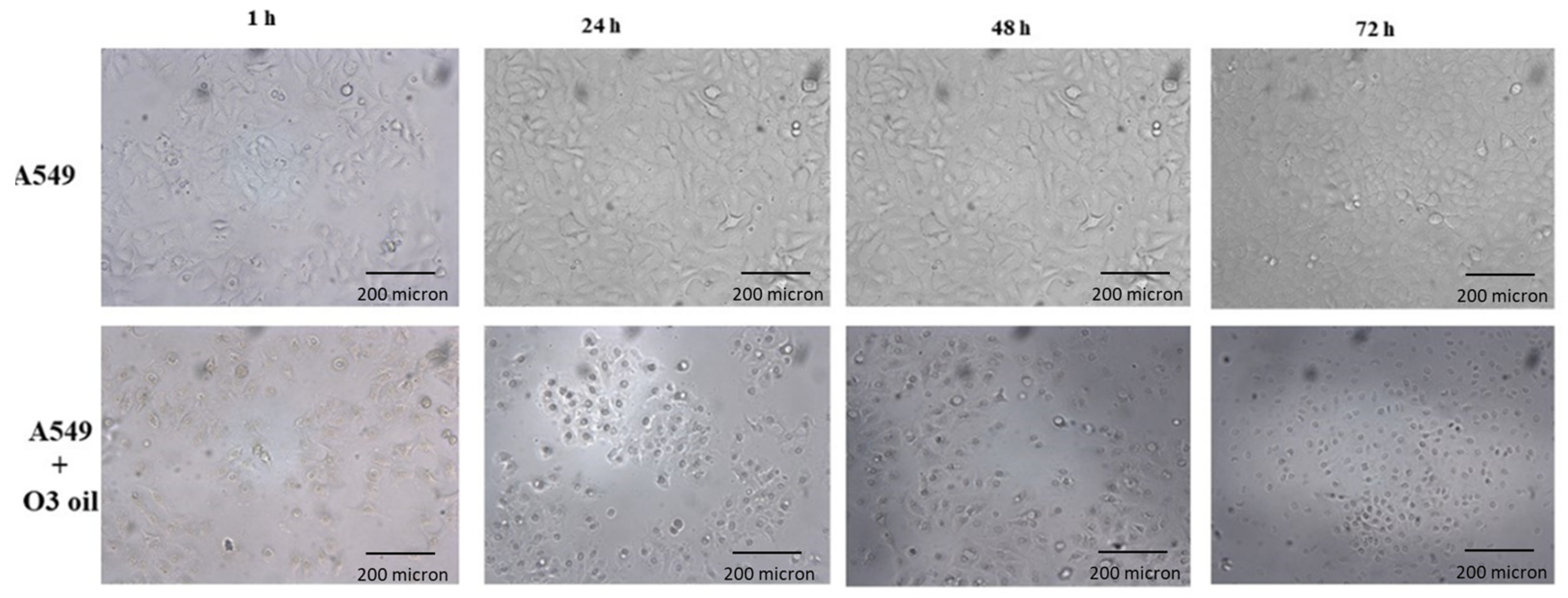 Cancers 14 01174 g002