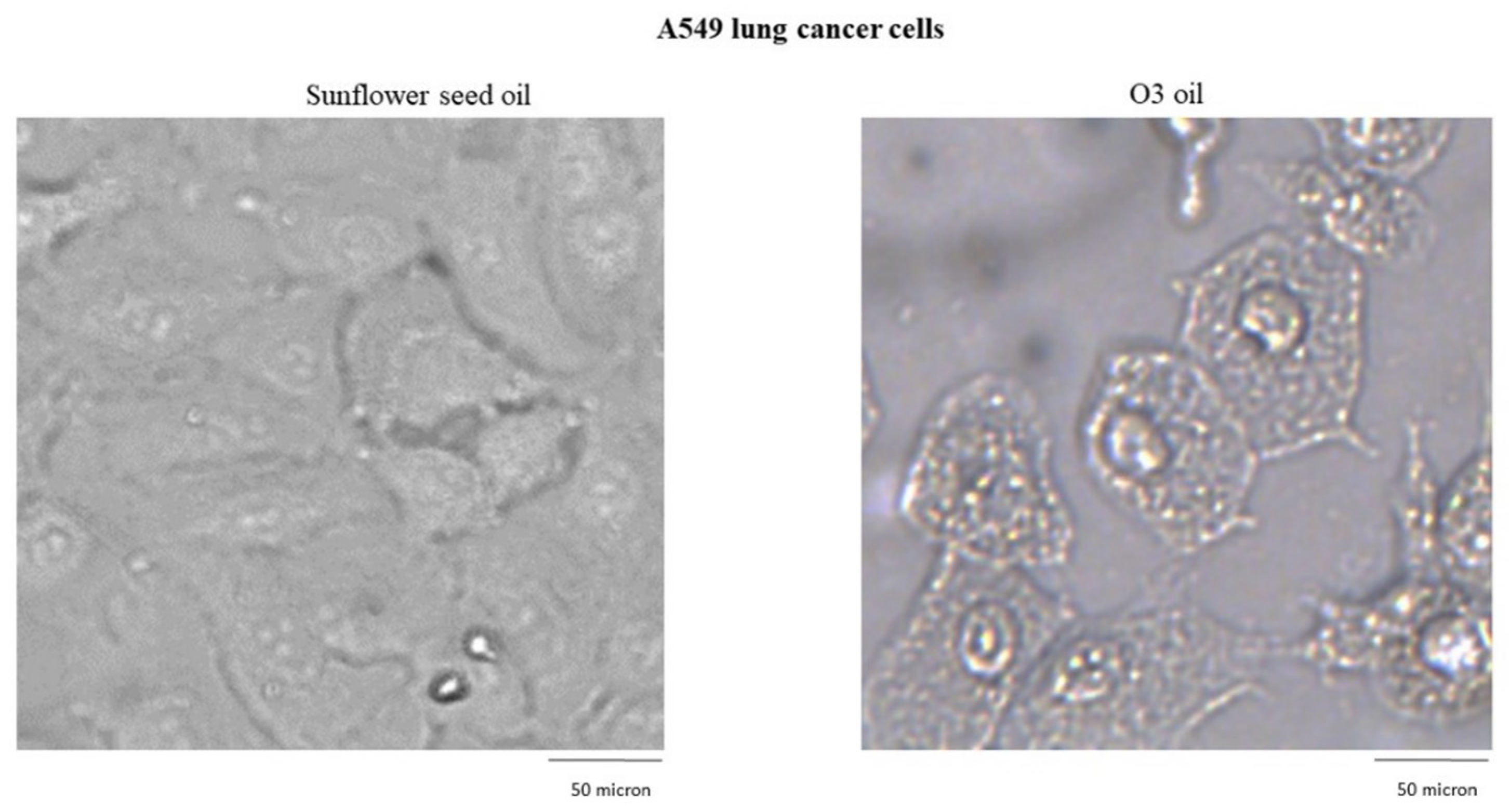 Cancers 14 01174 g005