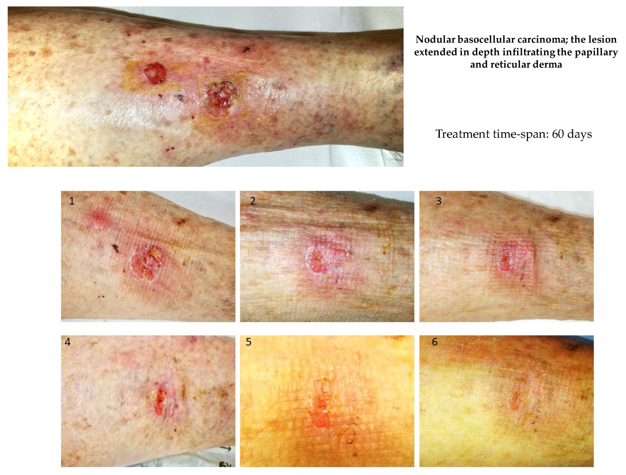 Cancers 14 01174 g014