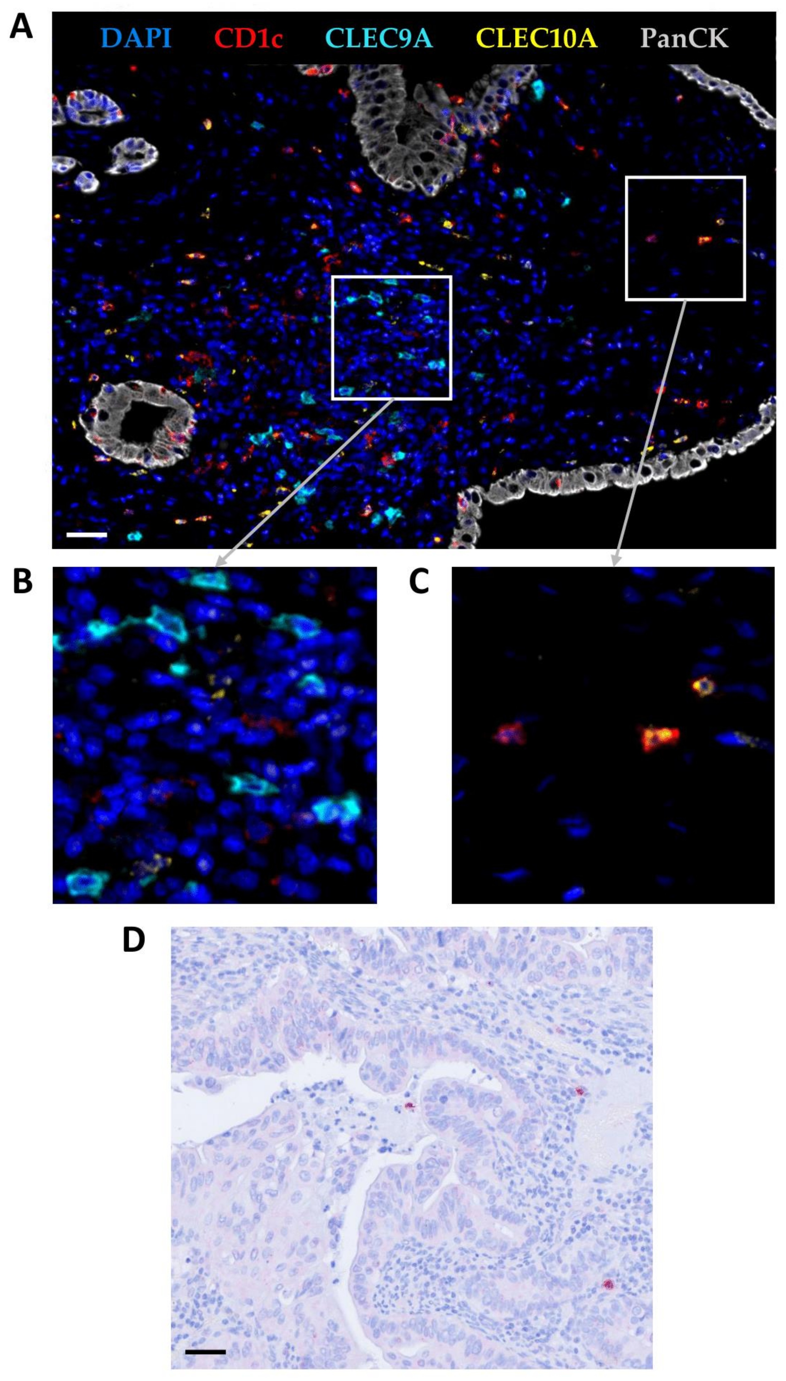 Cancers 14 01216 g001