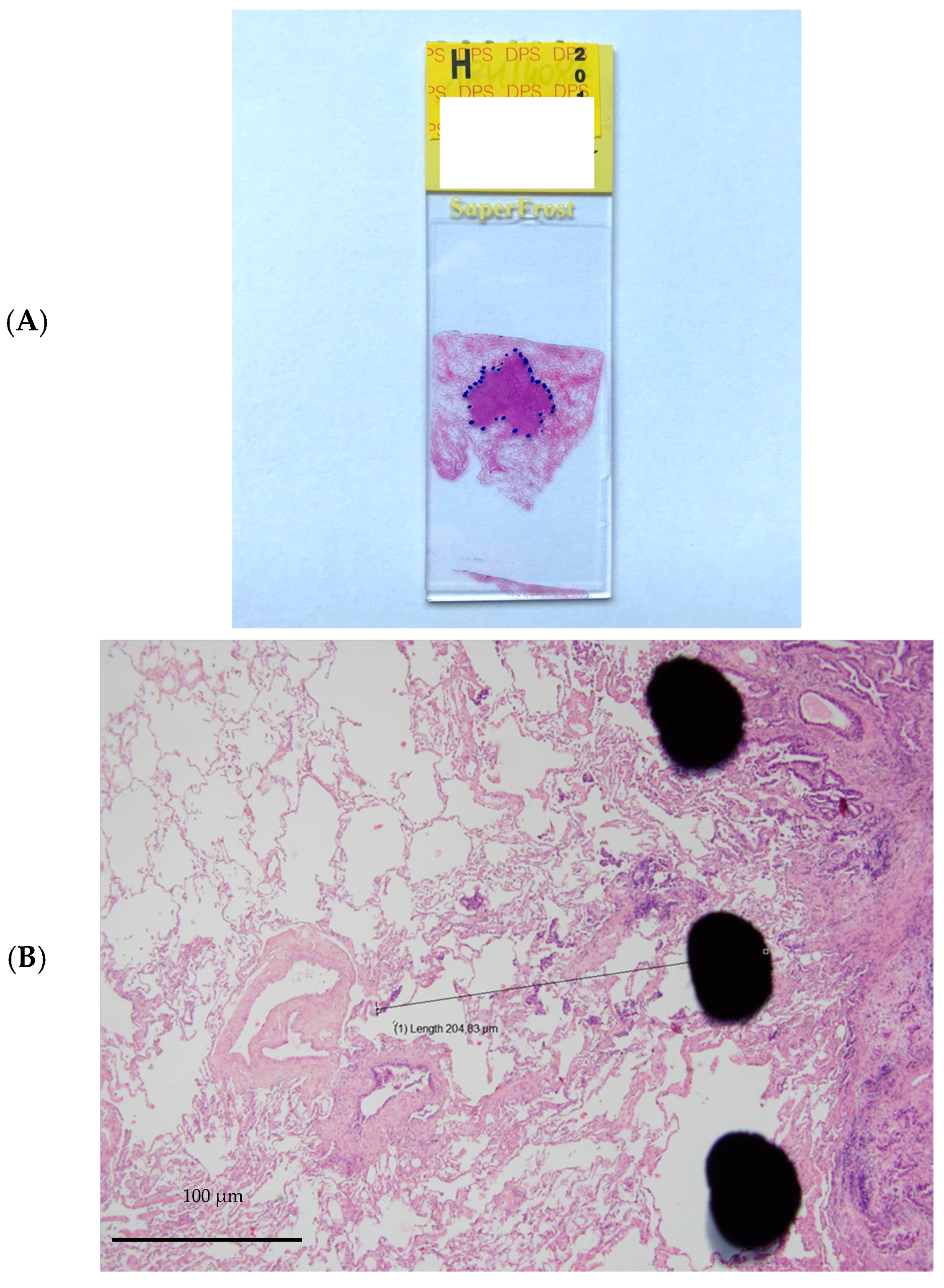 Cancers 14 01282 g001