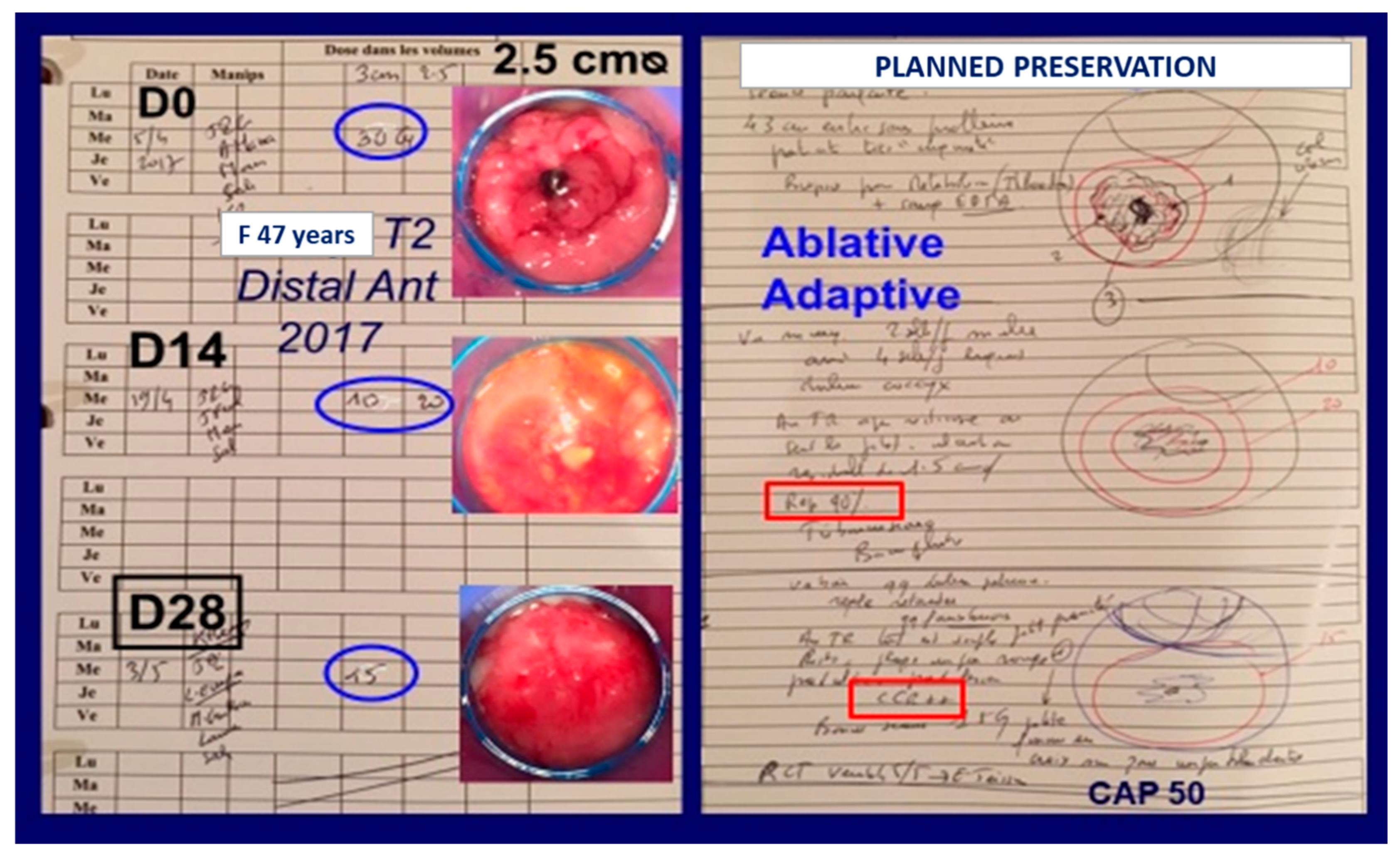 Cancers 14 01313 g002