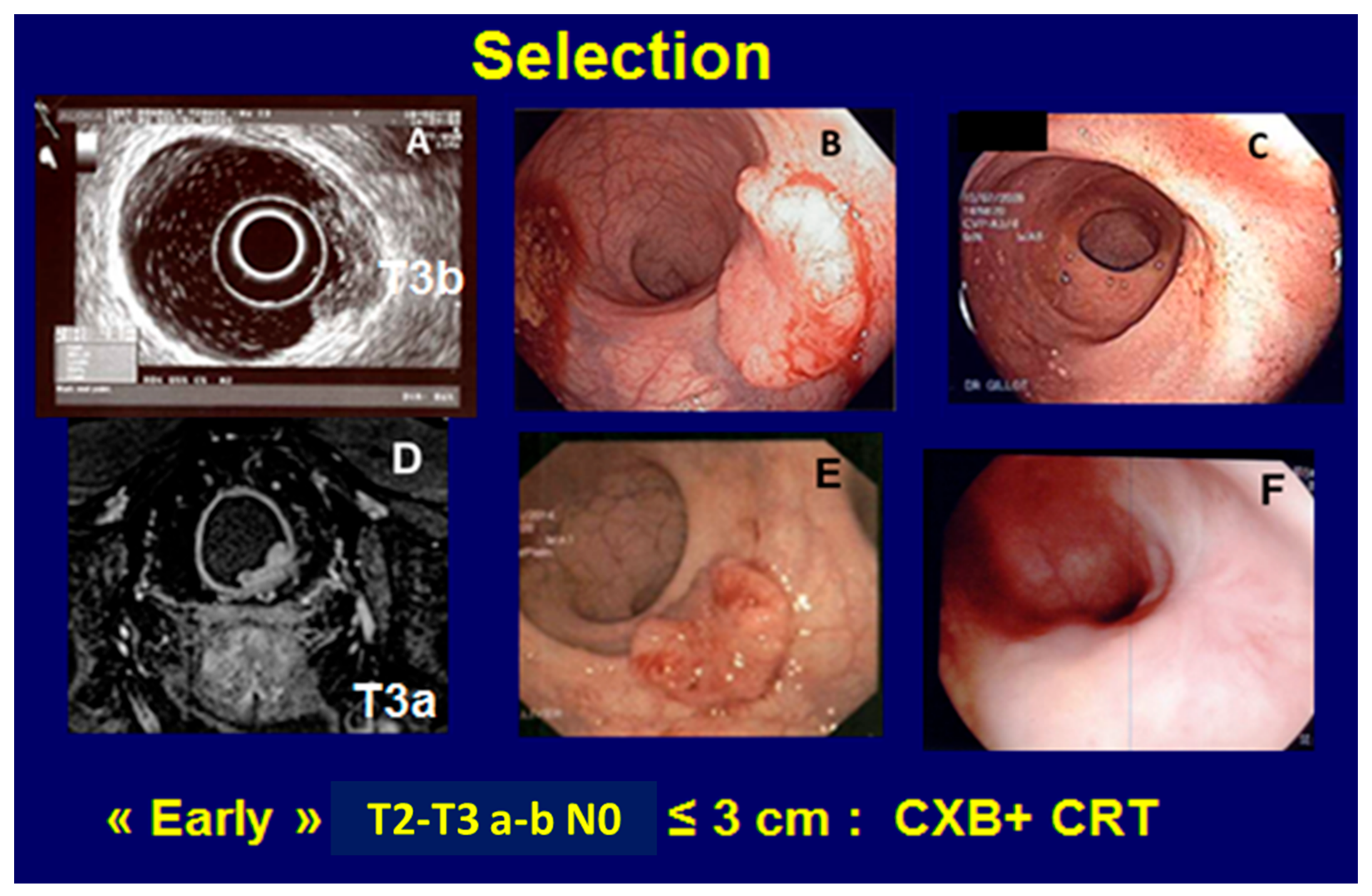 Cancers 14 01313 g003