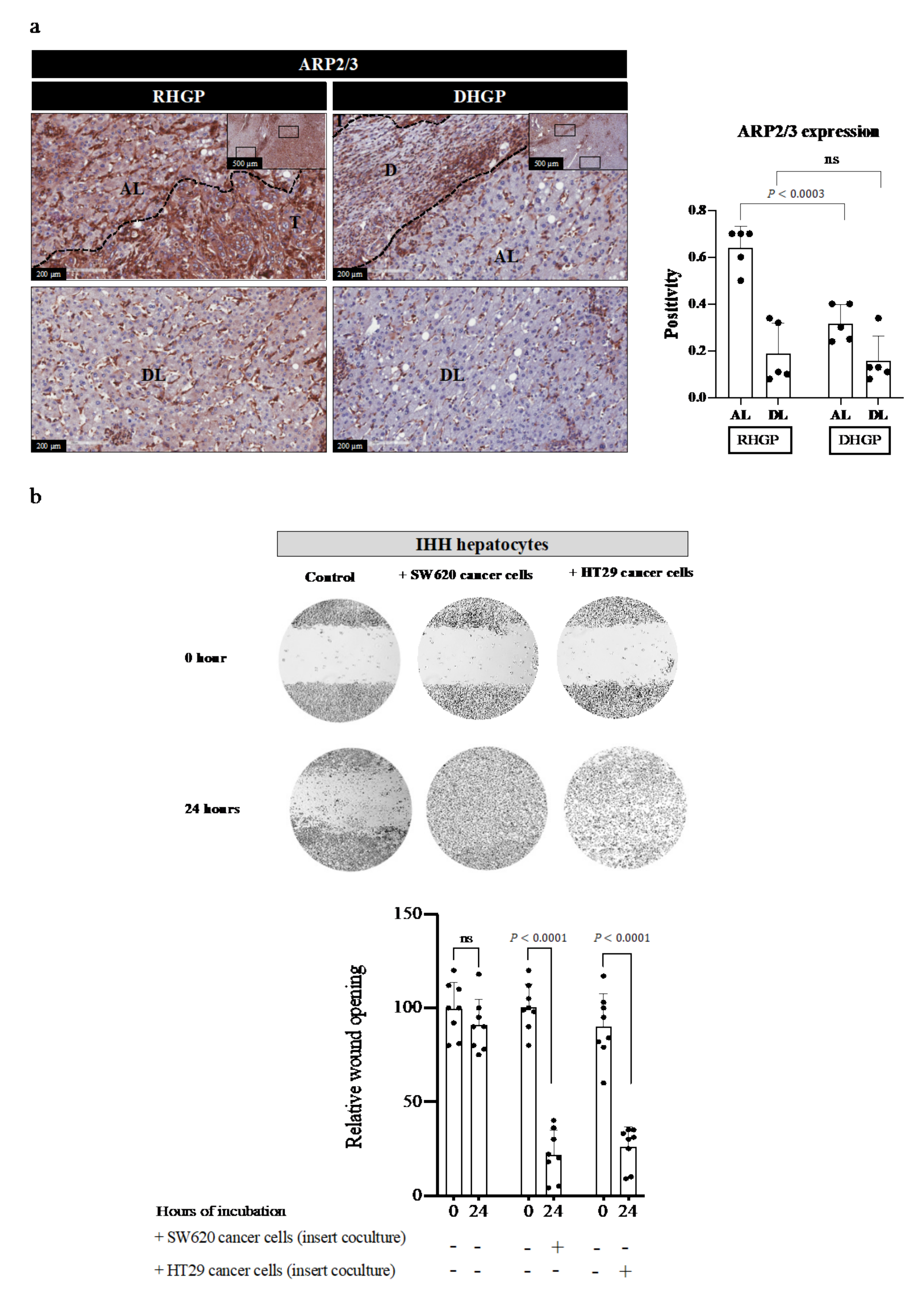 Cancers 14 01318 g004 Cancers 14 01318 g004