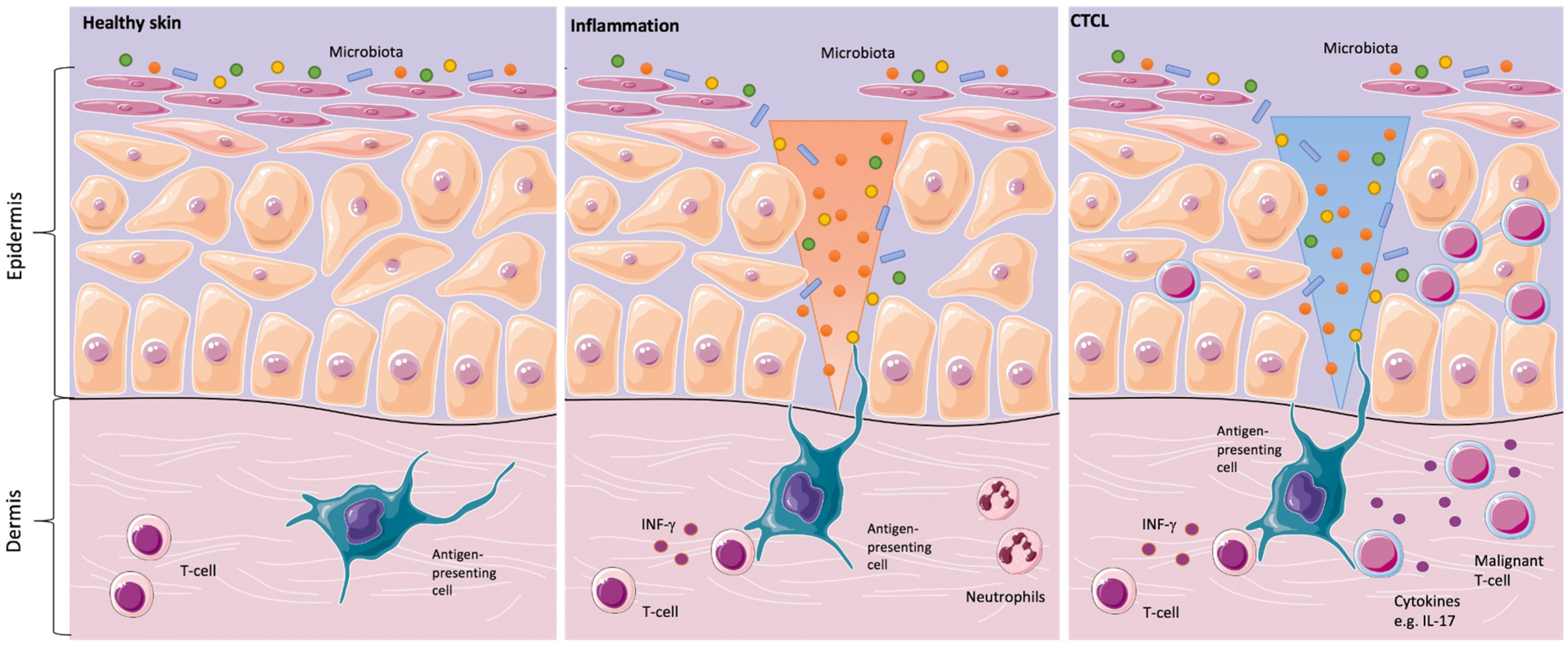 Cancers 14 01324 g001