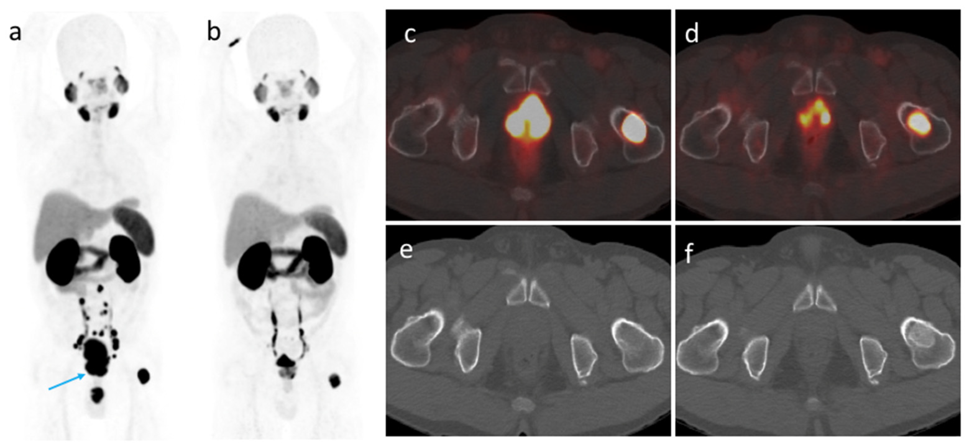 Cancers 14 01329 g003