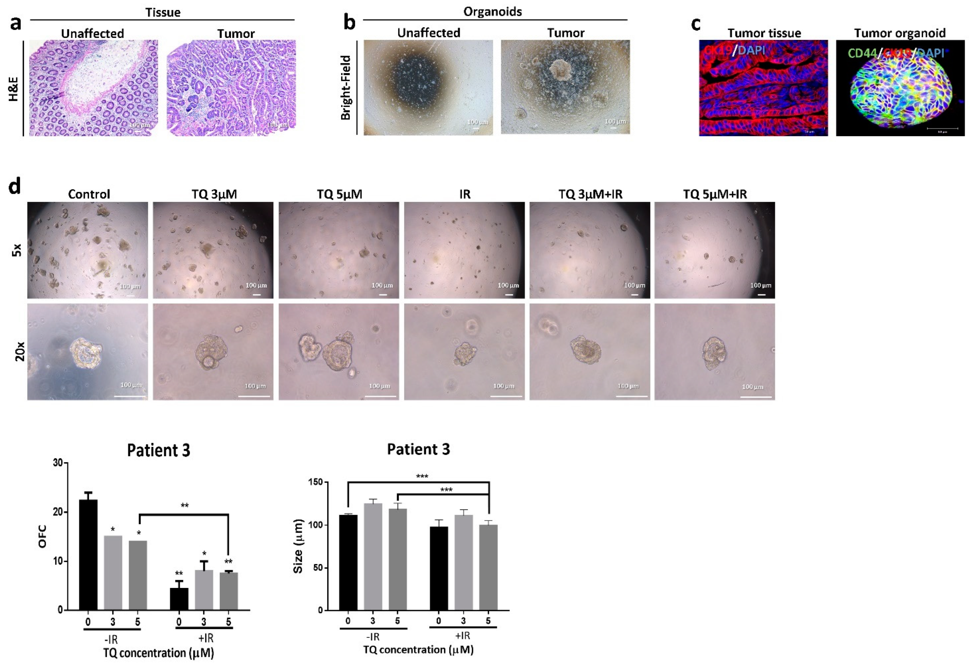 Cancers 14 01363 g008