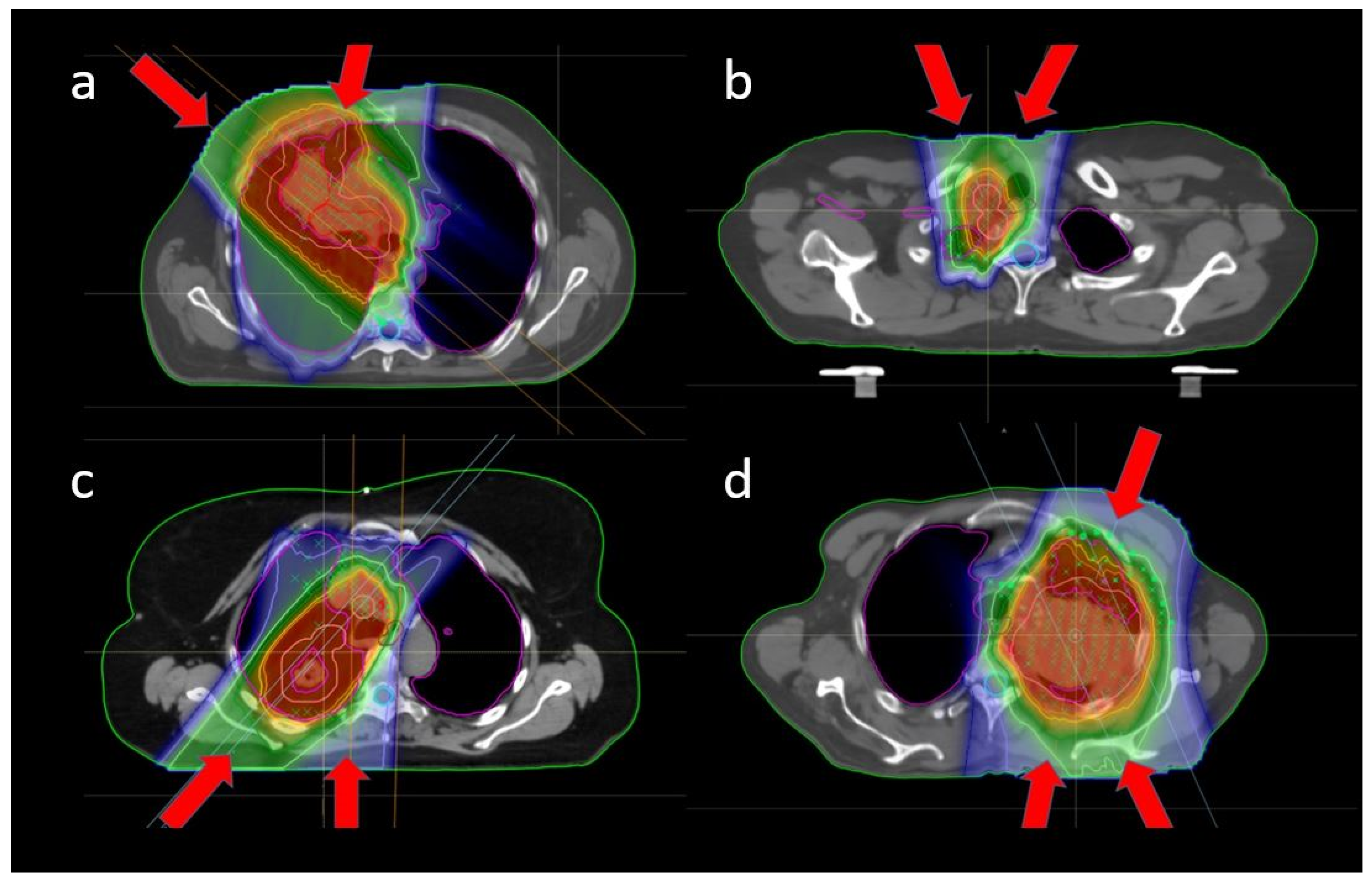 Cancers 14 01365 g0a1