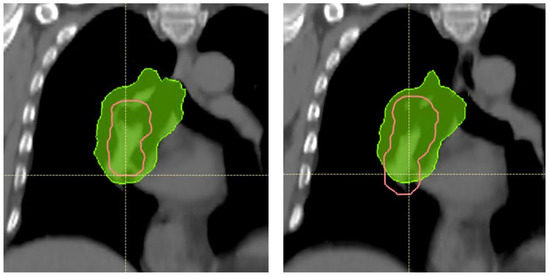Cancers 14 01365 g0a2 550