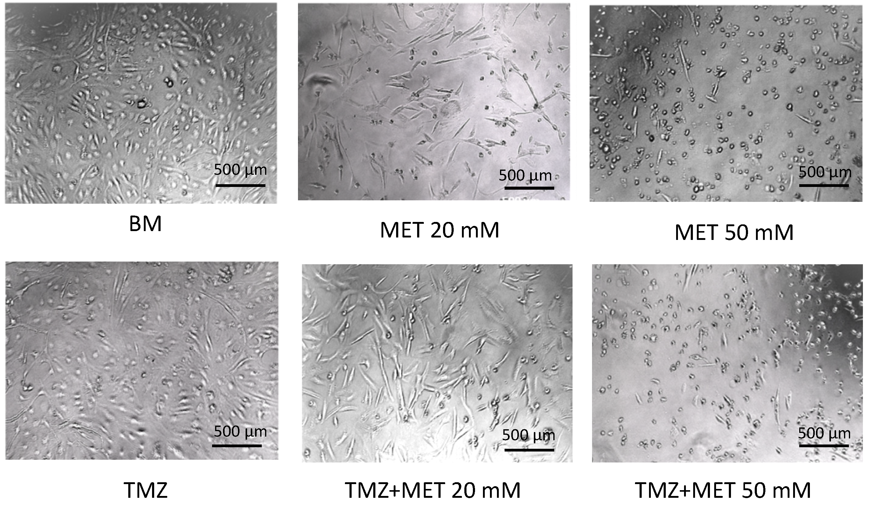 Cancers 14 01412 g002