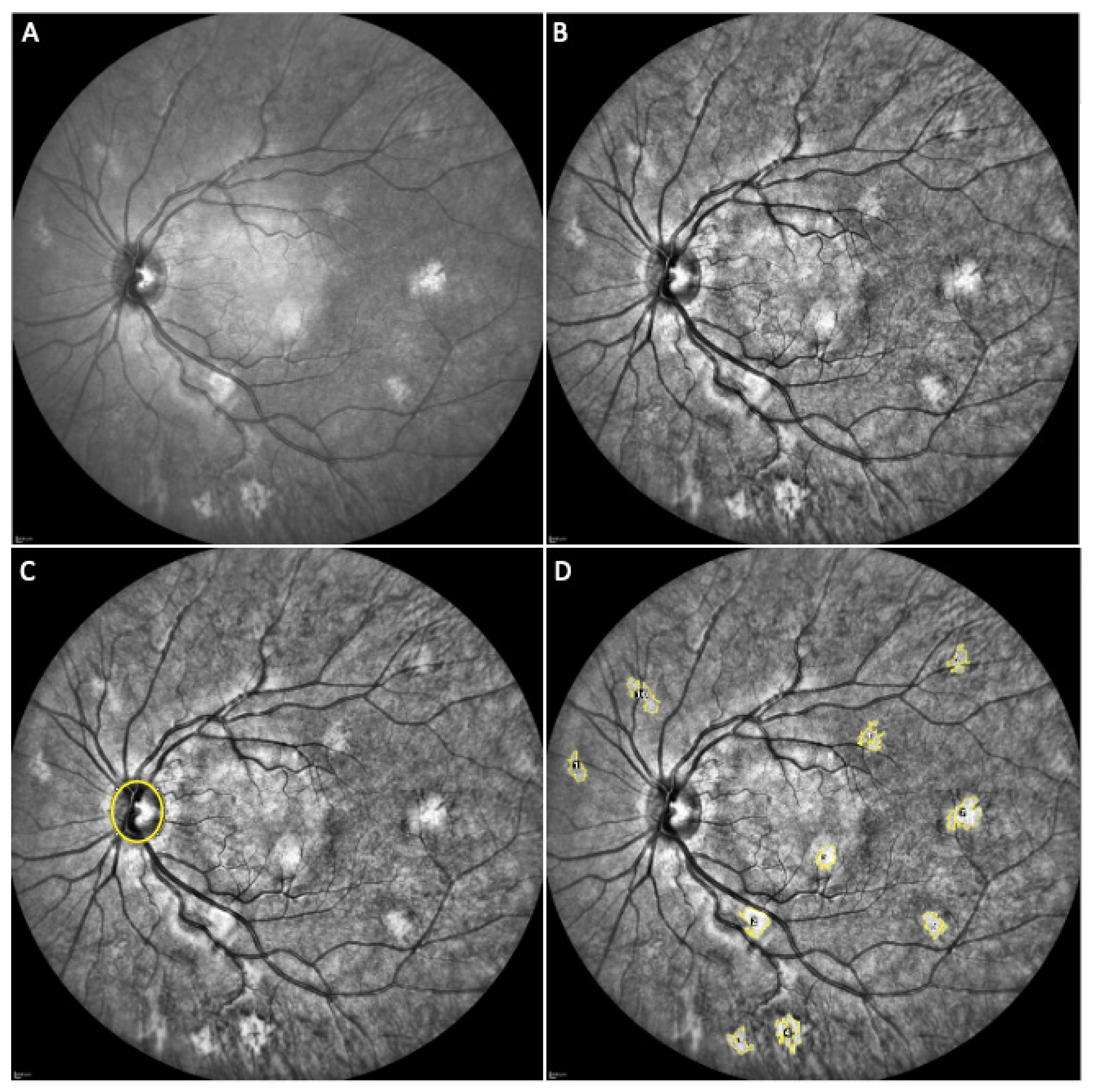 Cancers 14 01423 g001