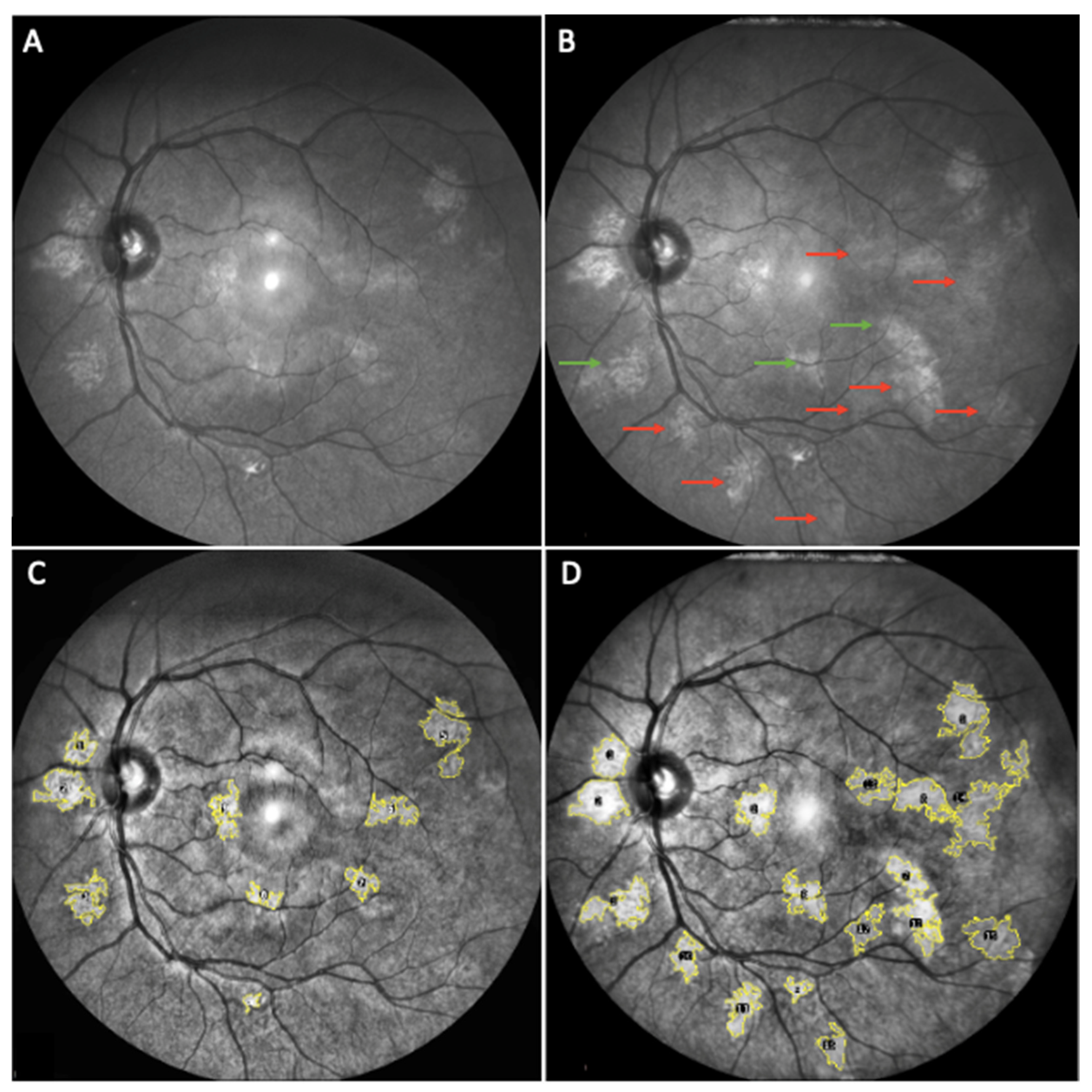 Cancers 14 01423 g002