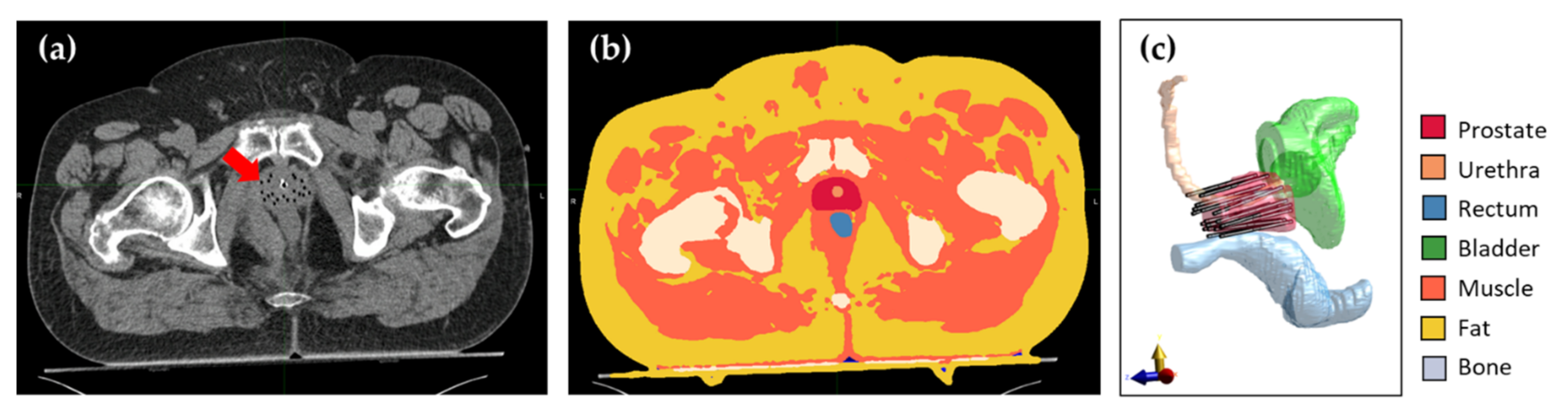 Cancers 14 01425 g002