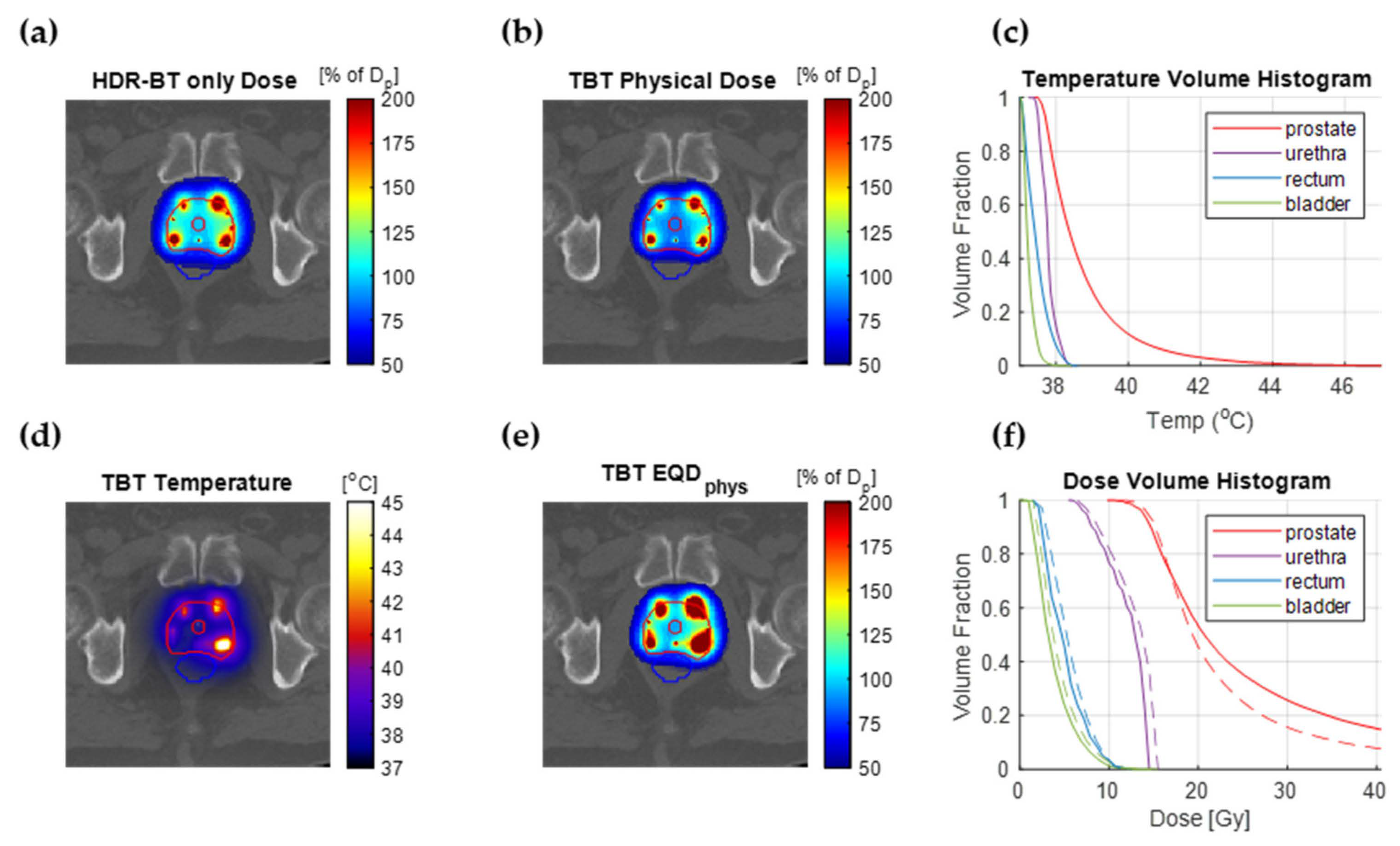 Cancers 14 01425 g006