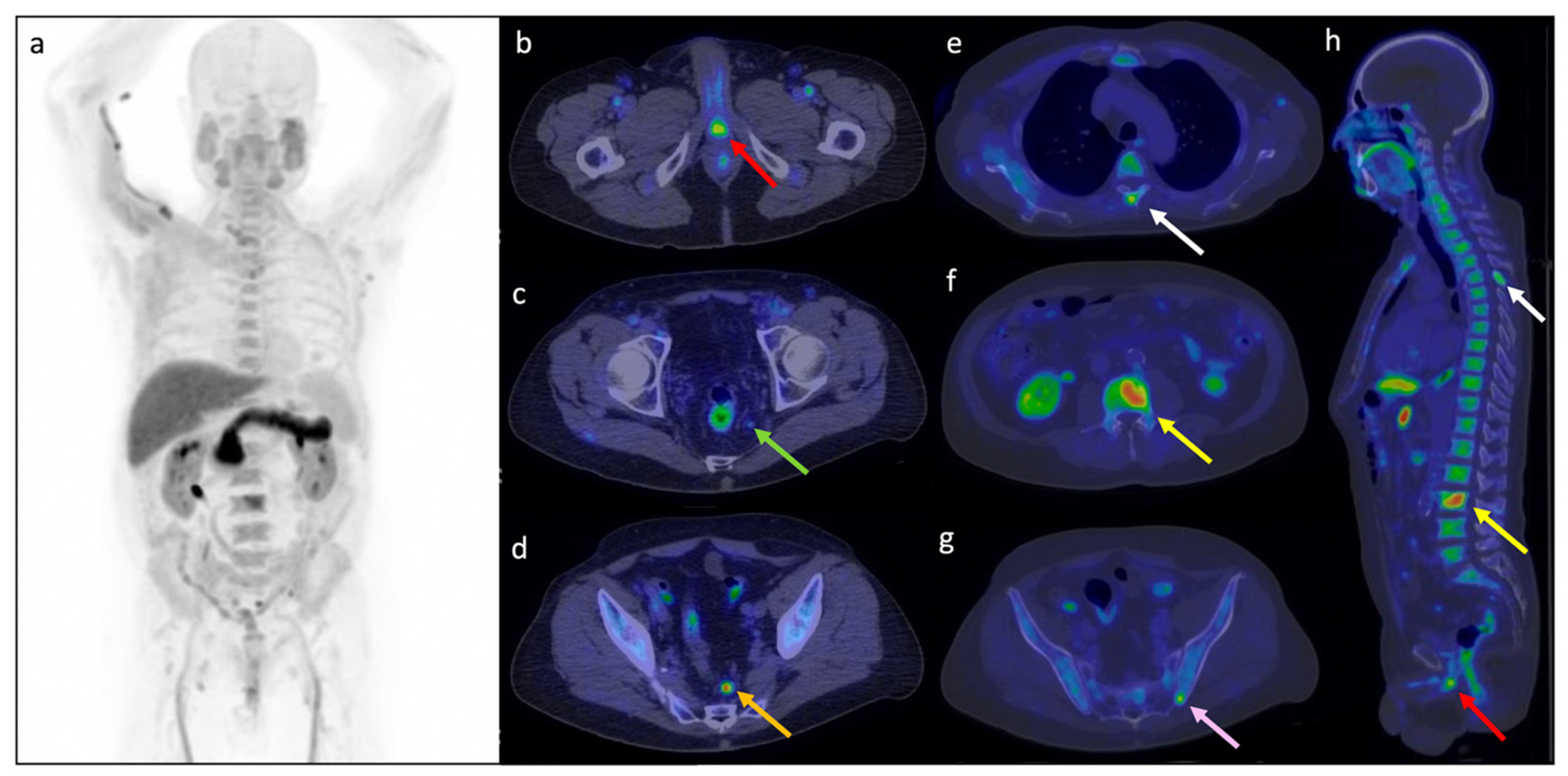 Cancers 14 01461 g007