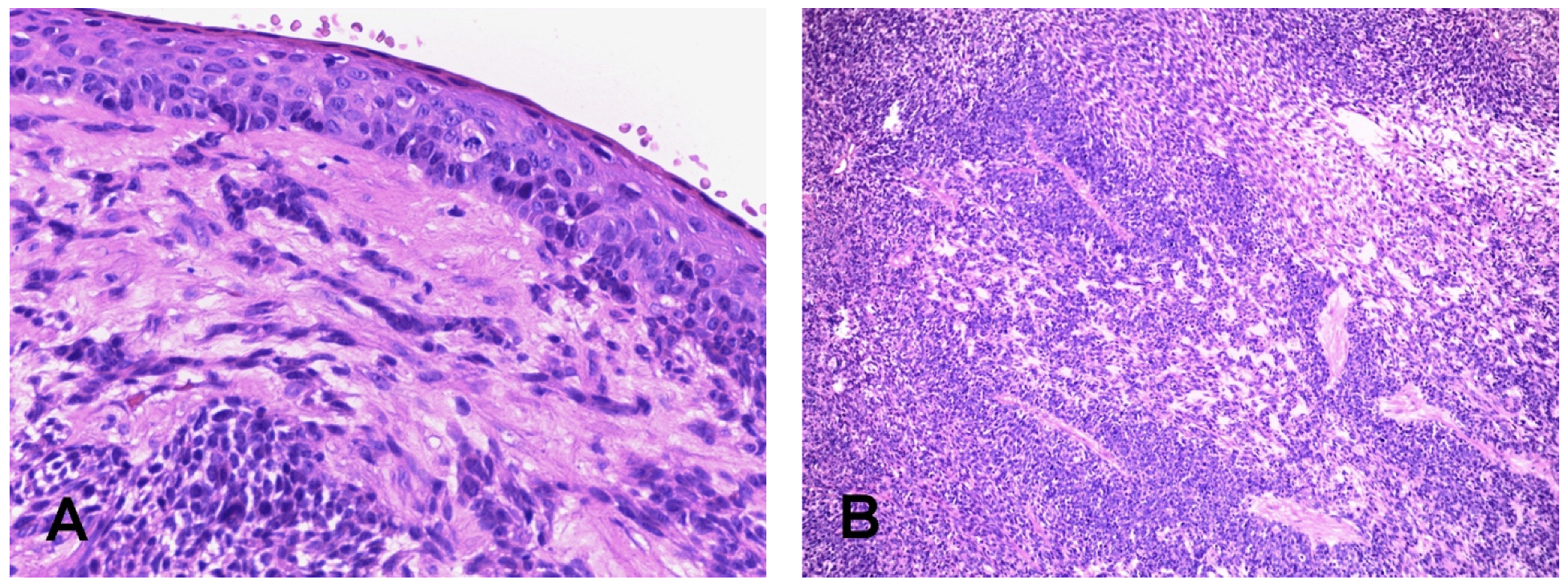 Cancers 14 01463 g001