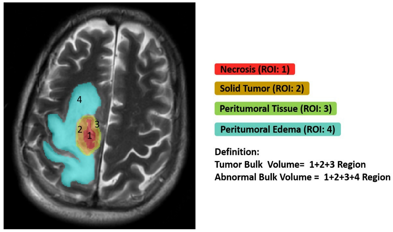 Cancers 14 01475 g002