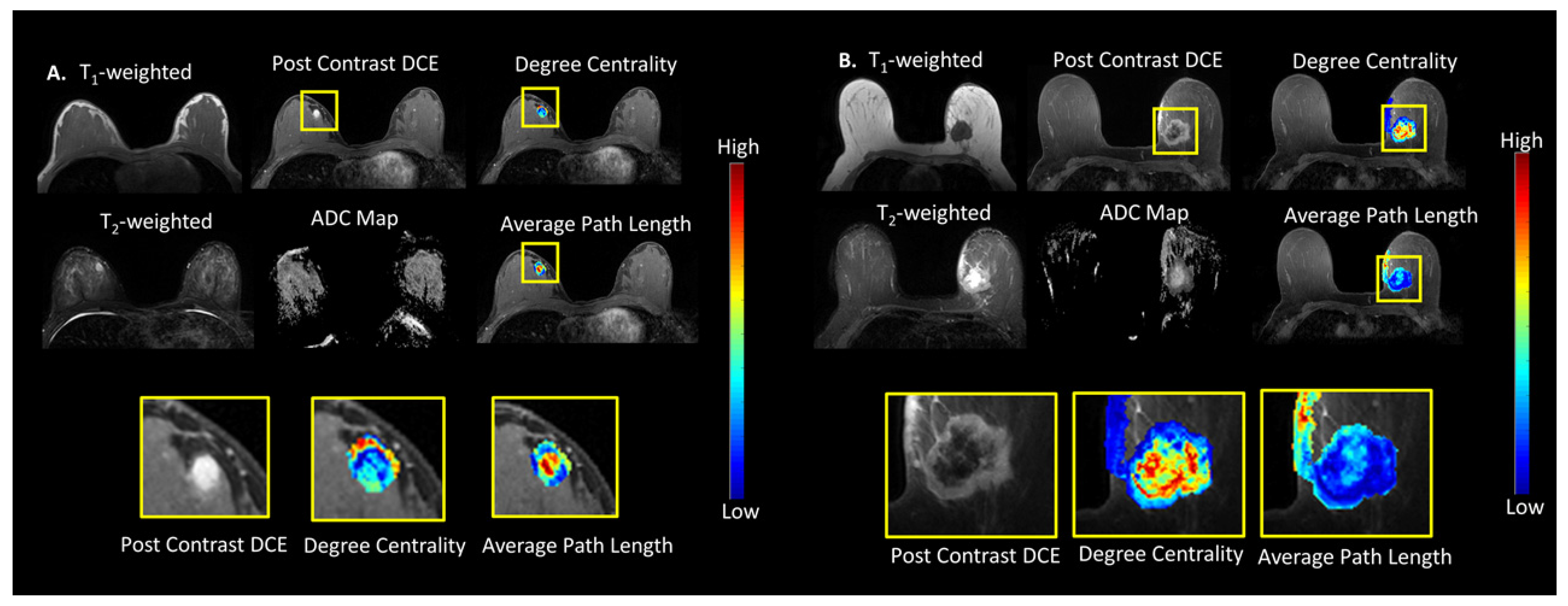 Cancers 14 01481 g002