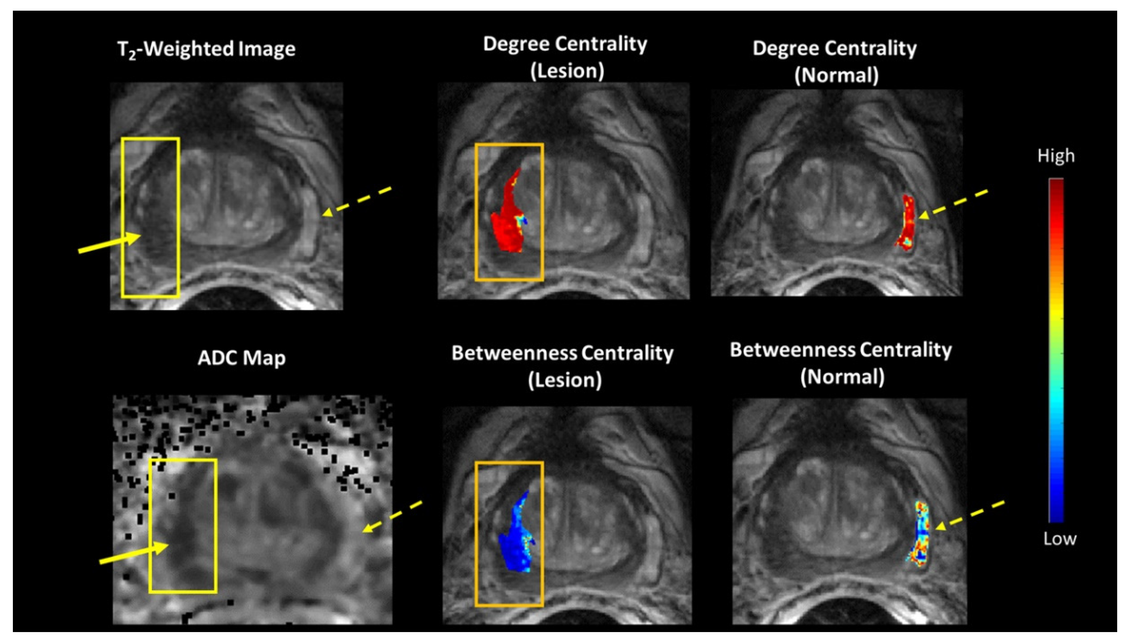 Cancers 14 01481 g005