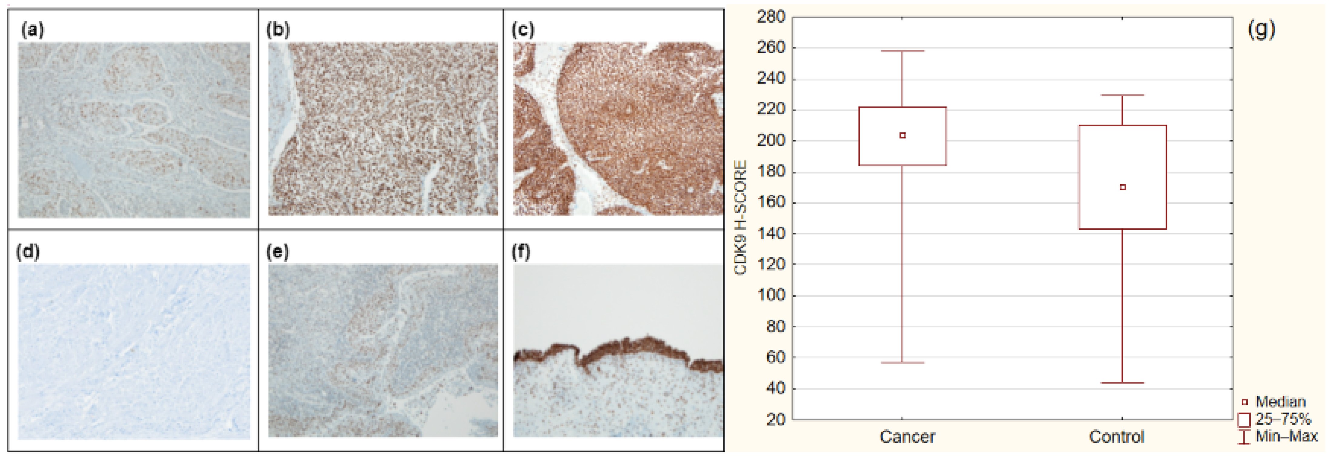 Cancers 14 01492 g001