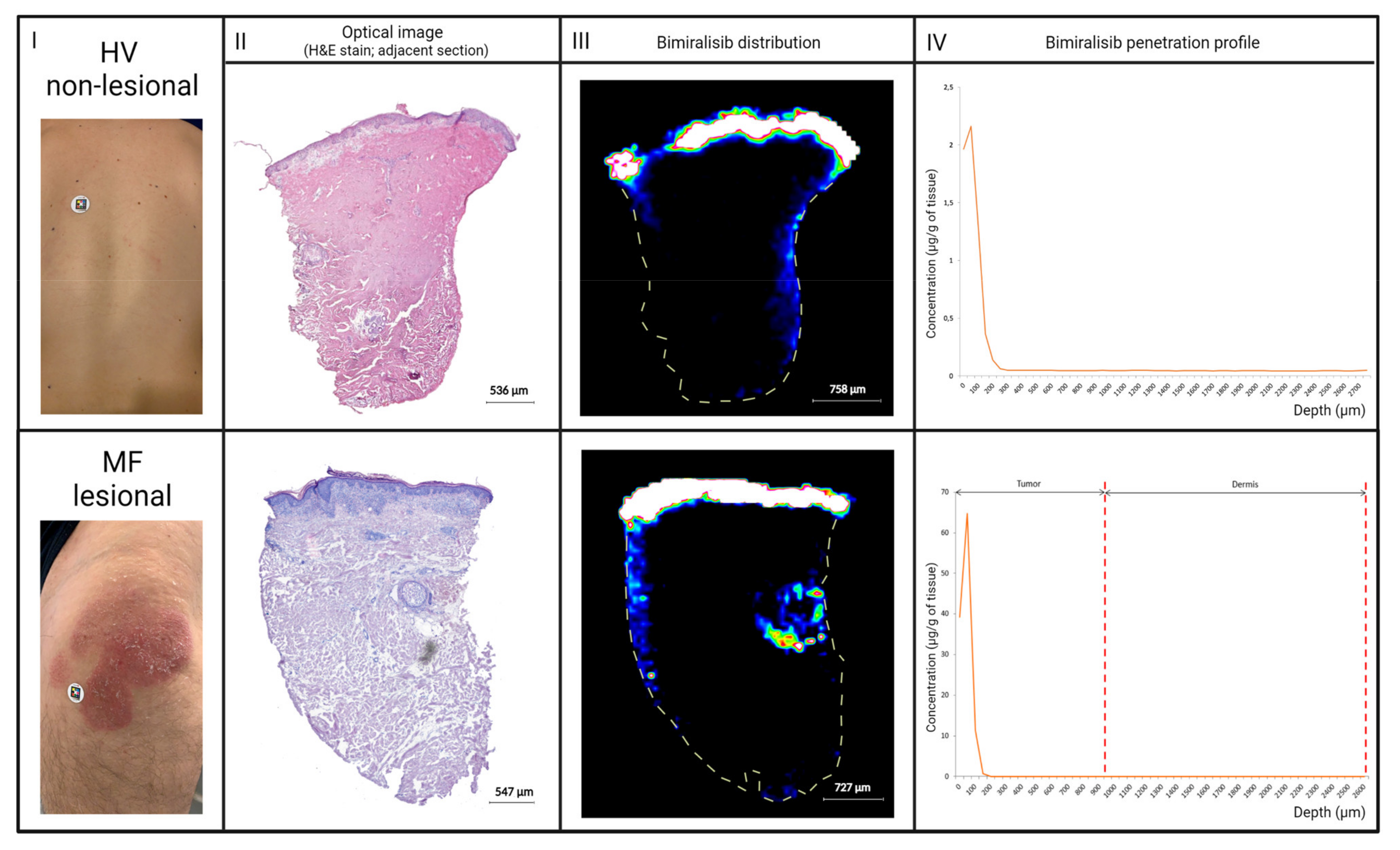 Cancers 14 01510 g005