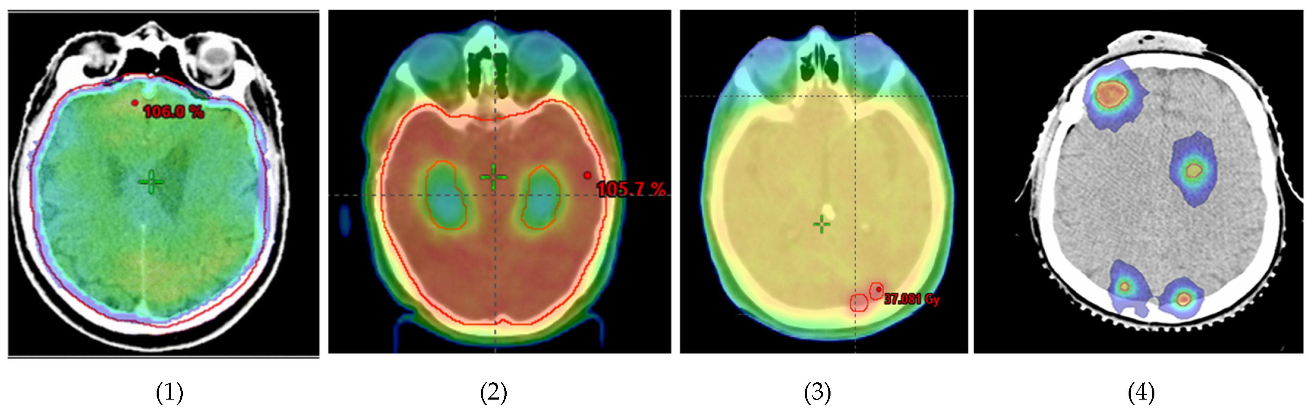 Cancers 14 01514 g001