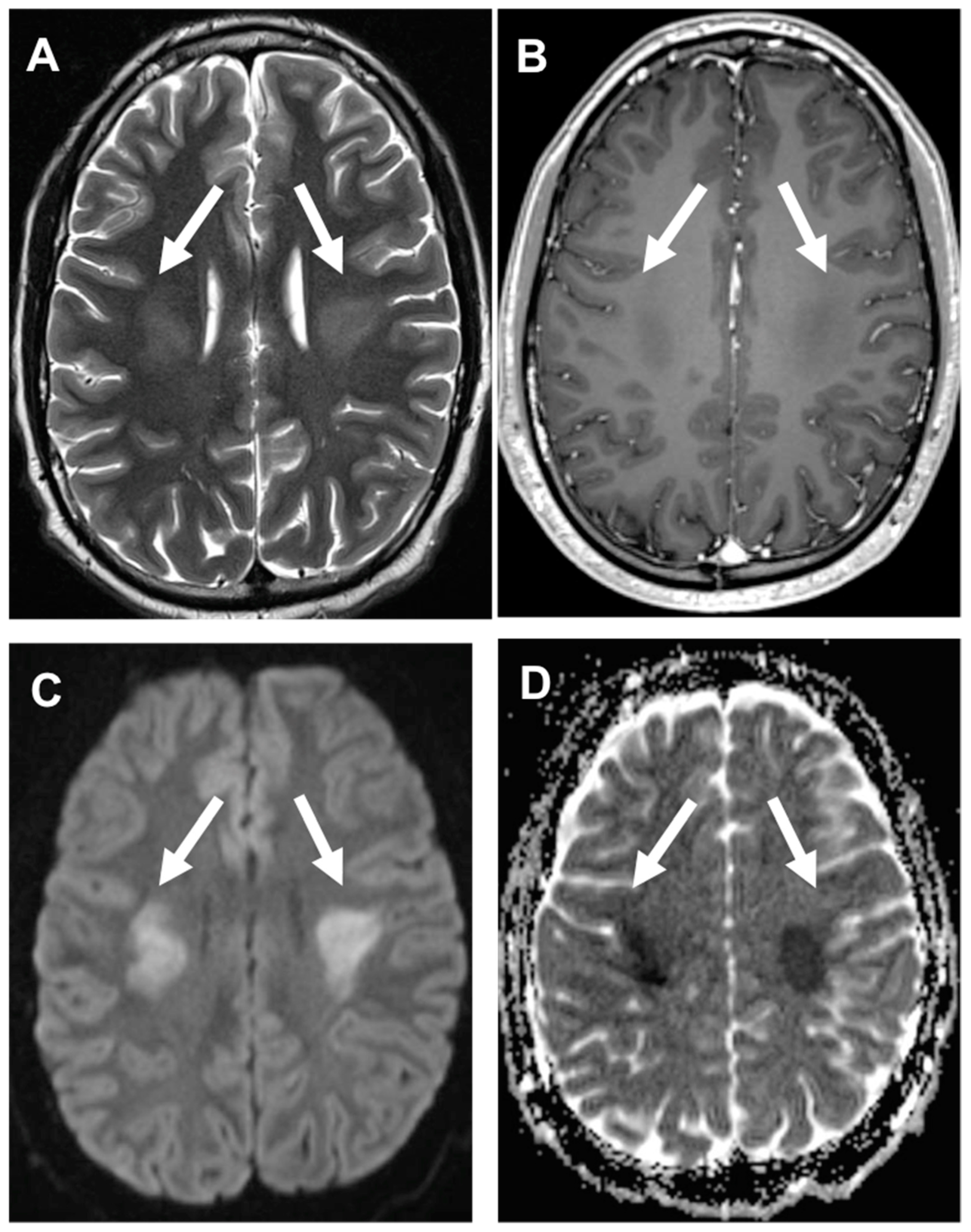 Cancers 14 01540 g002