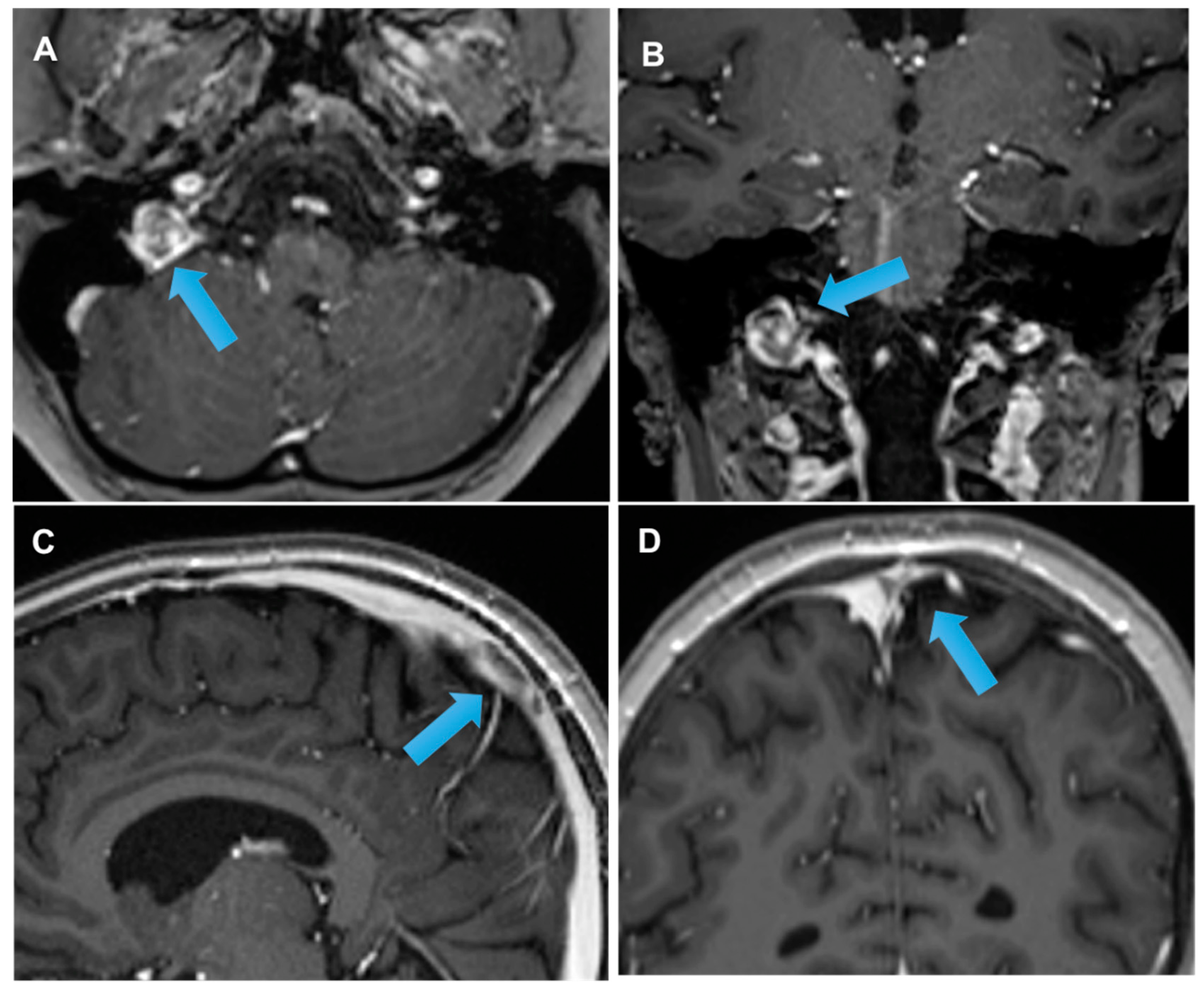 Cancers 14 01540 g004