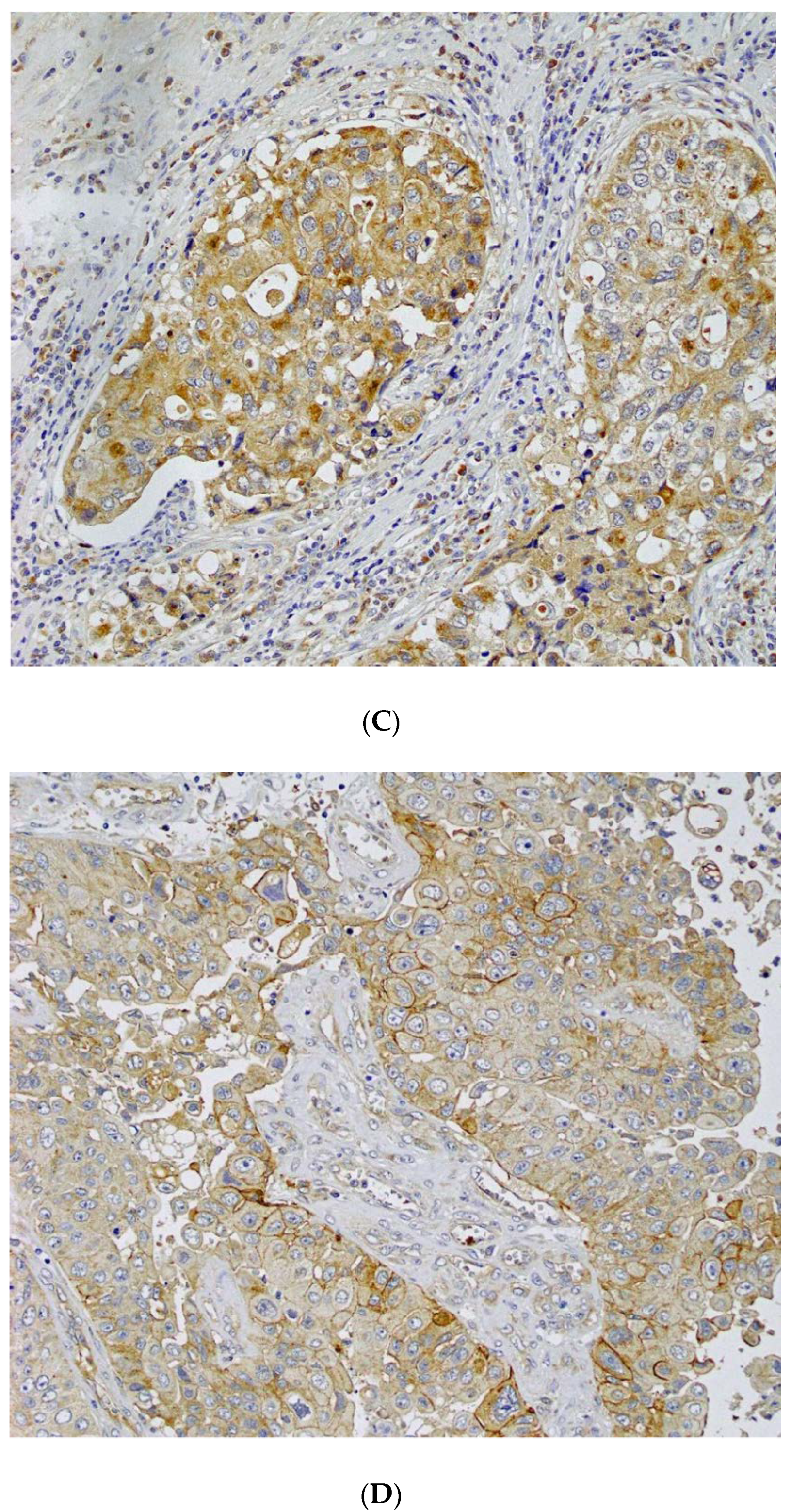 Cancers 14 01576 g001b