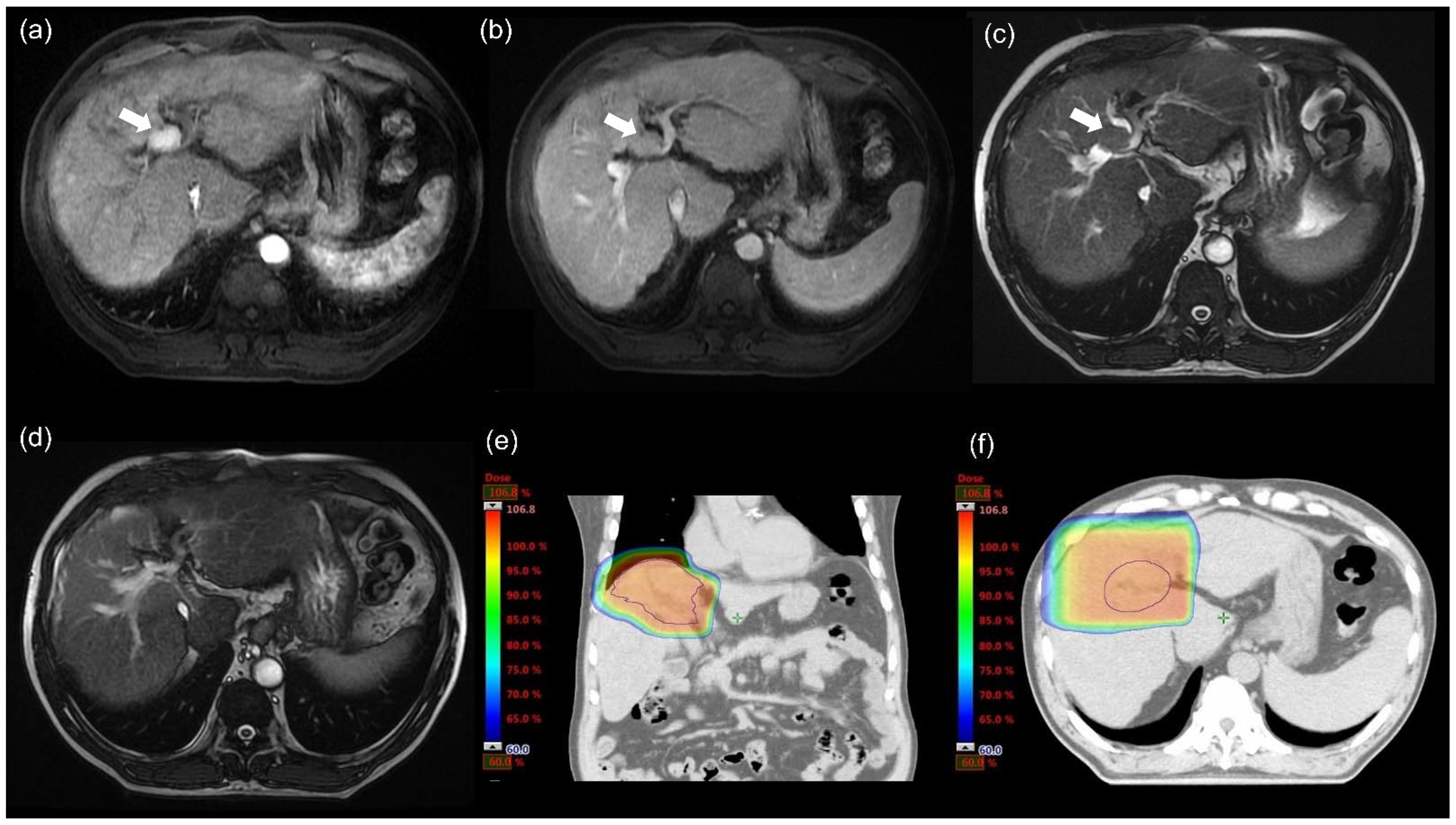 Cancers 14 01616 g001 Cancers 14 01616 g001