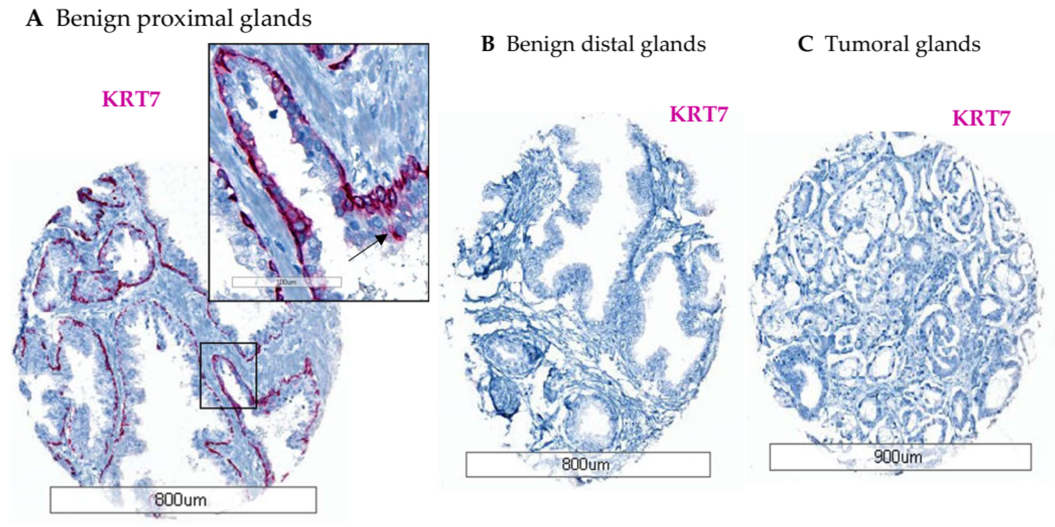 Cancers 14 01623 g001