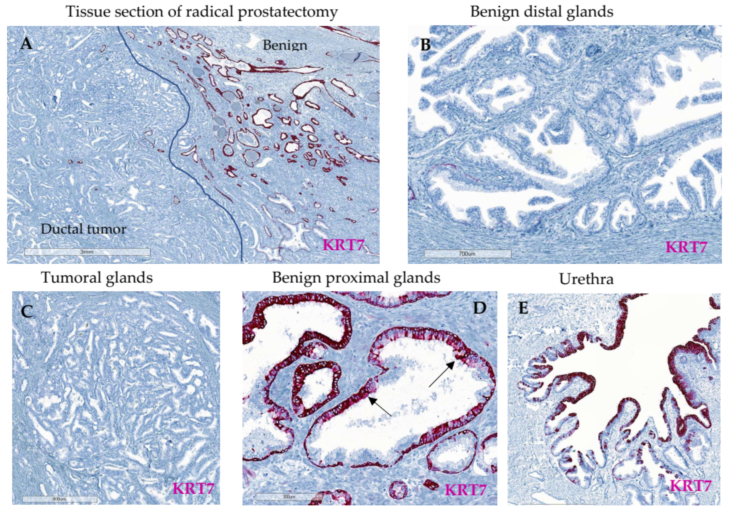 Cancers 14 01623 g002