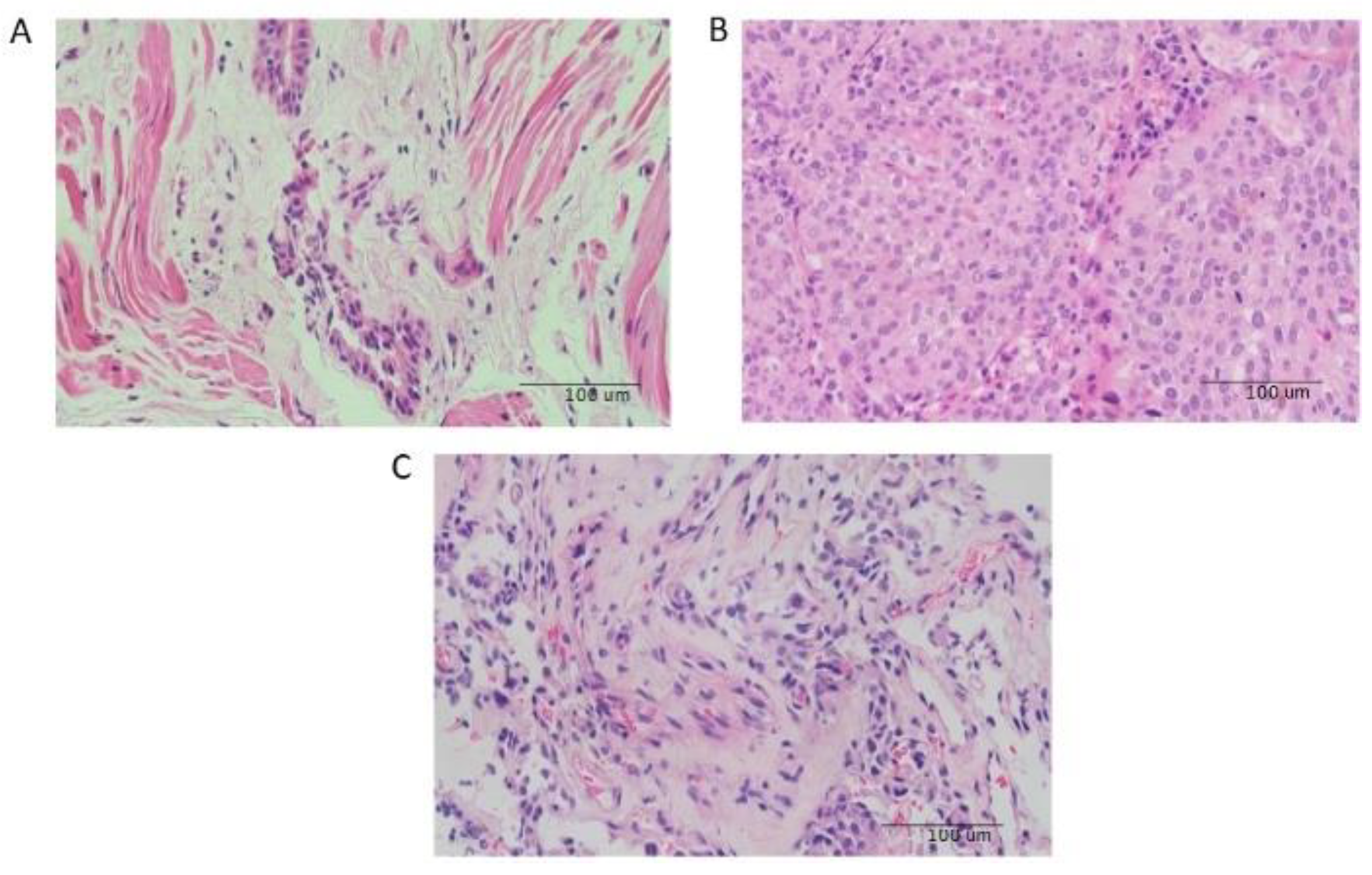 Cancers 14 01663 g001