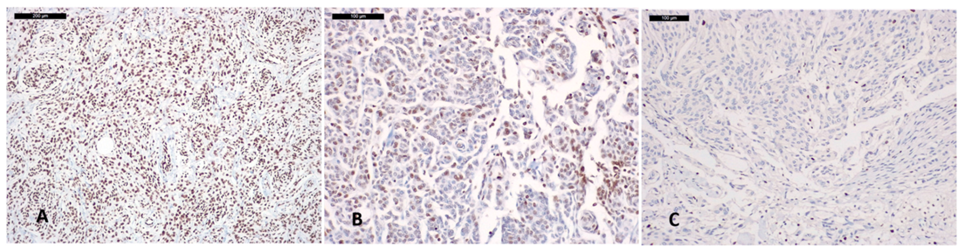 Cancers 14 01718 g002