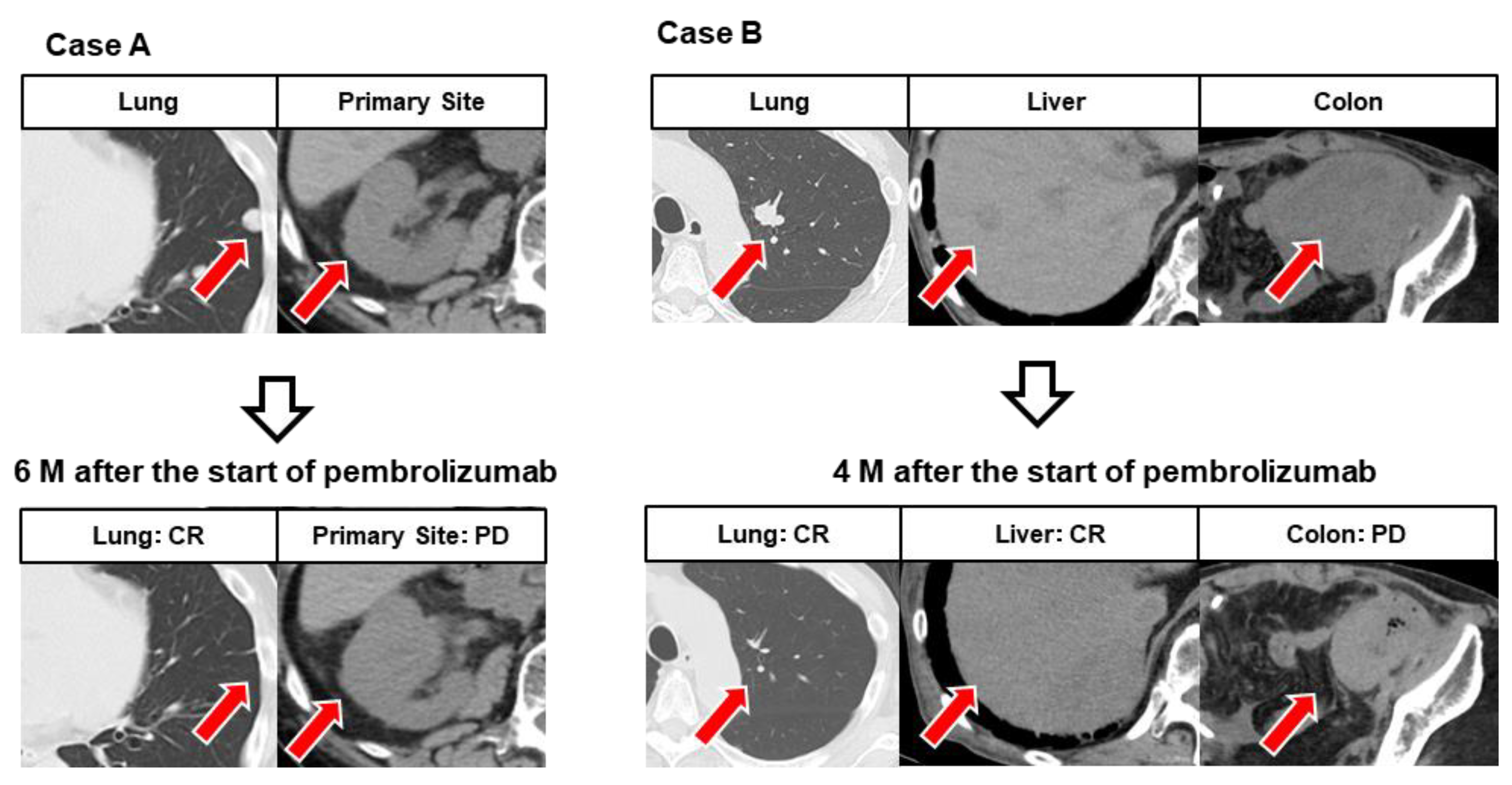 Cancers 14 01735 g004