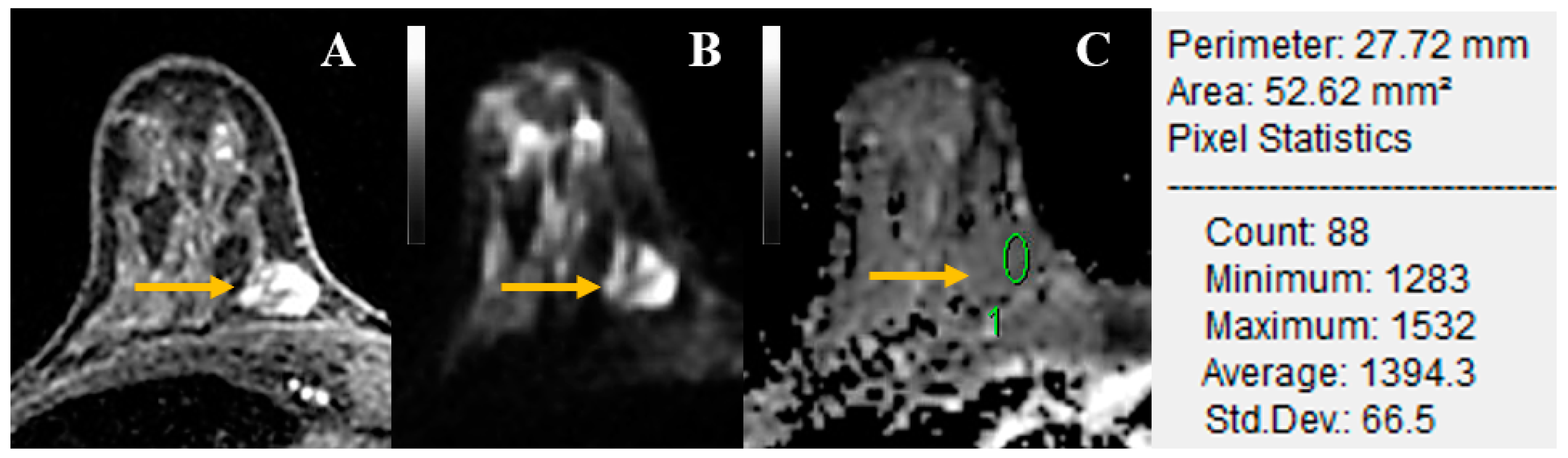 Cancers 14 01743 g002