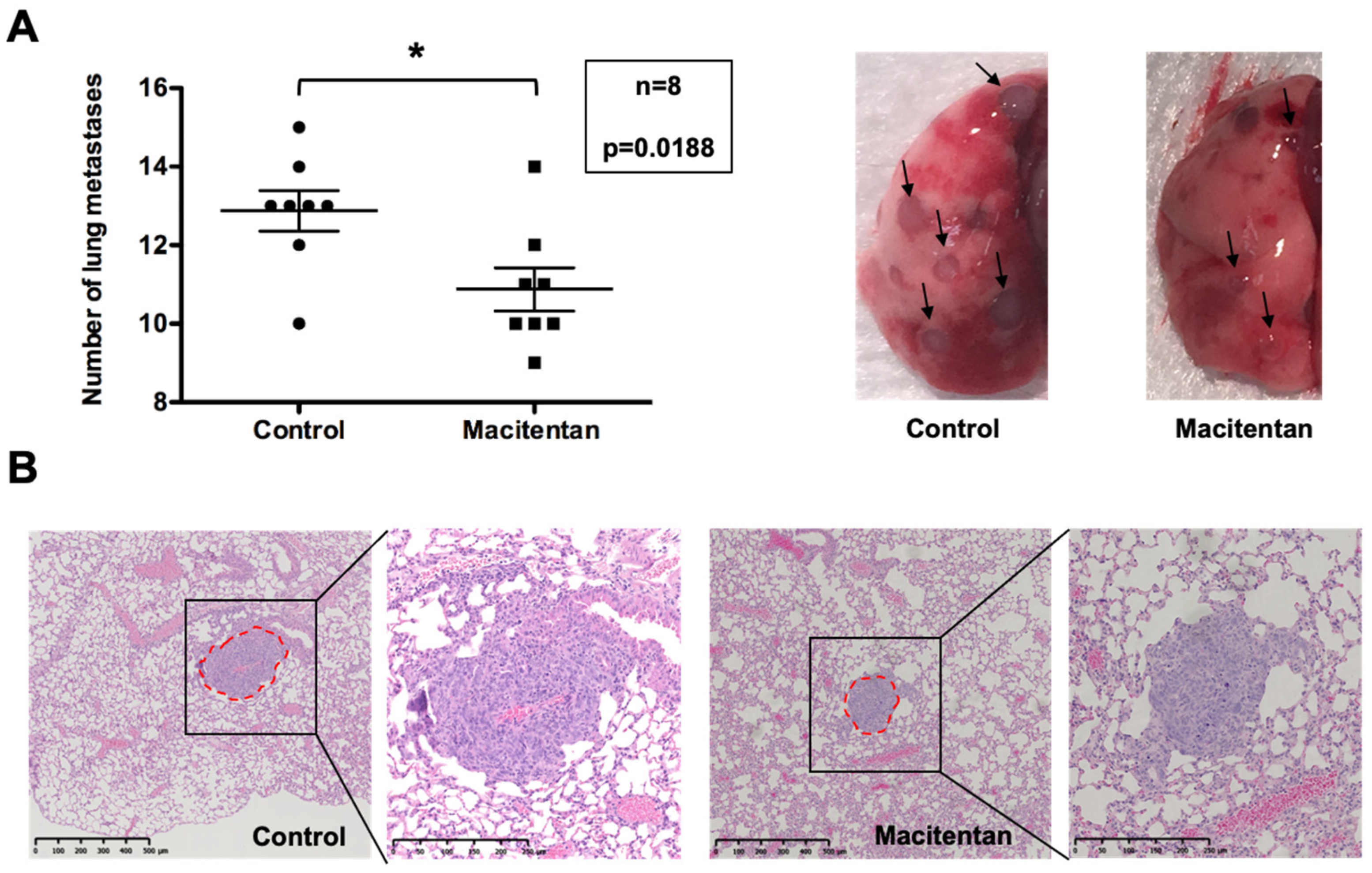 Cancers 14 01765 g006