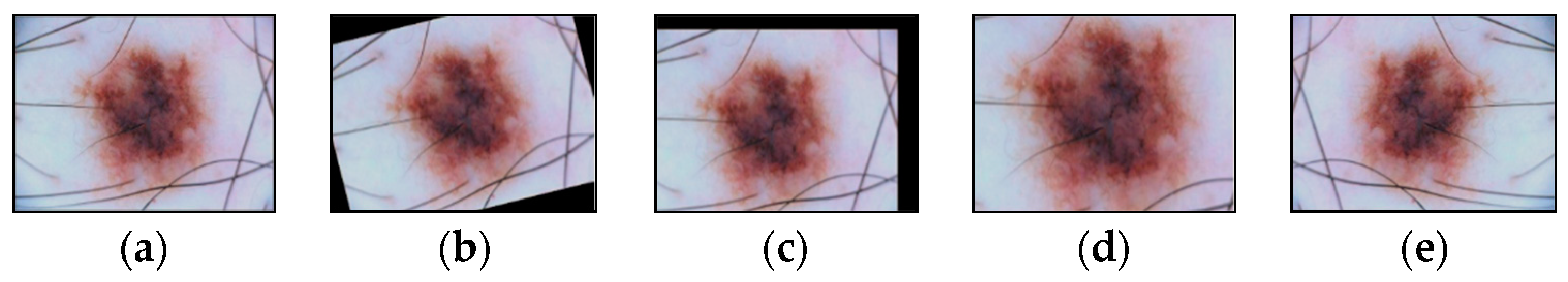 Cancers 14 01819 g011